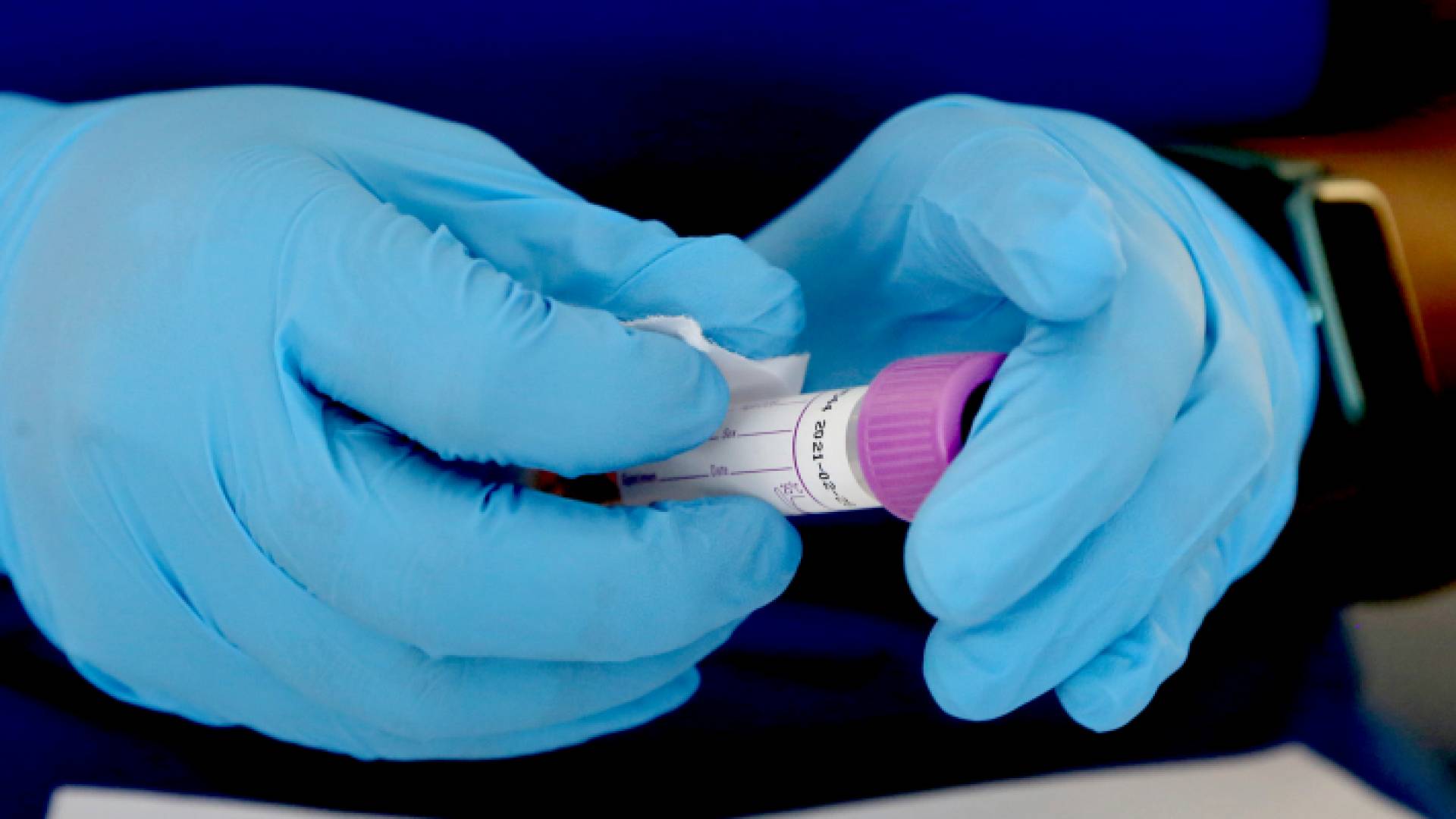 عينة فحص "بي سي آر"