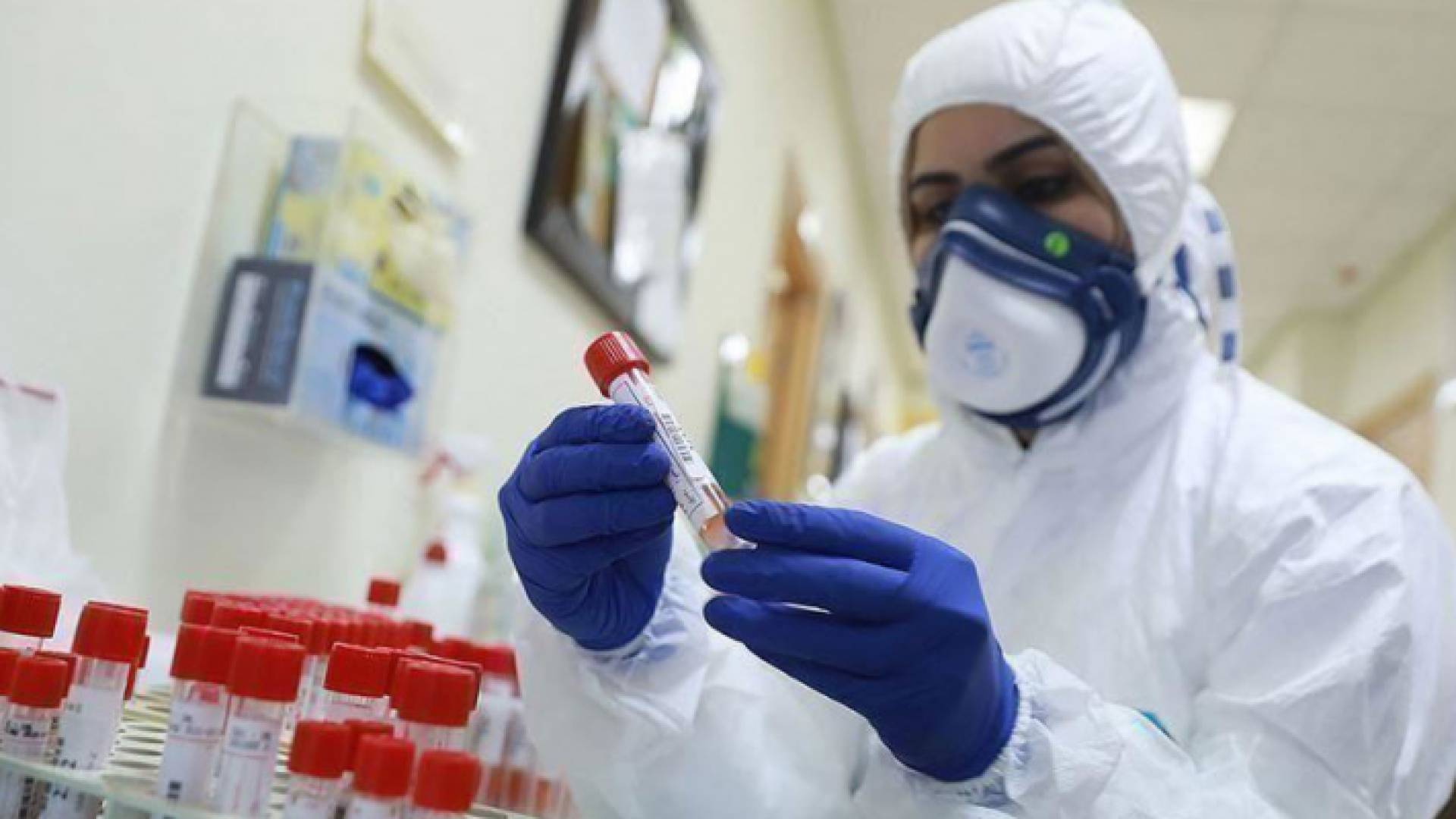 فحوص كورونا - أرشيفية