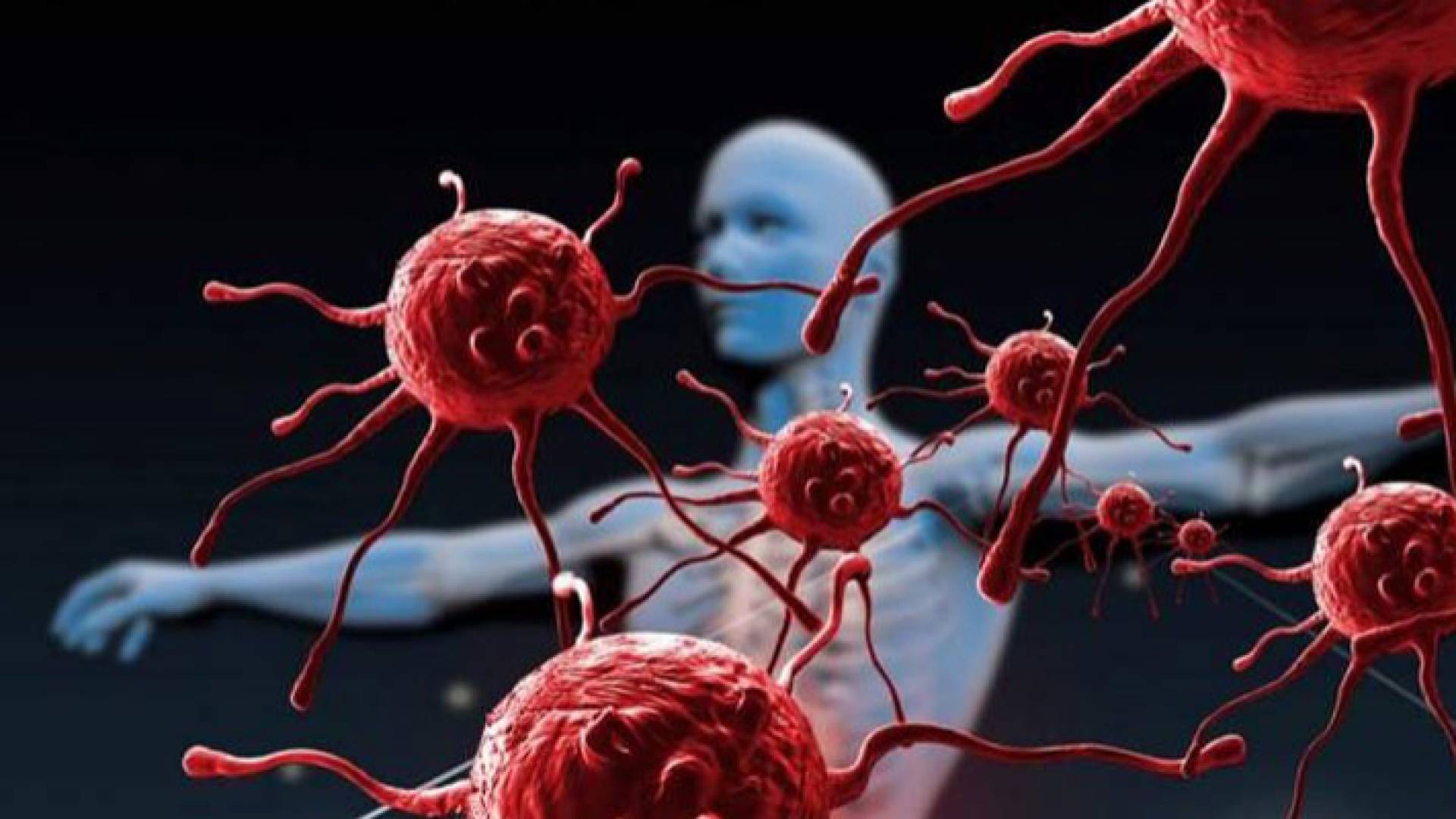 صورة تعبيرية لخلايا سرطانية