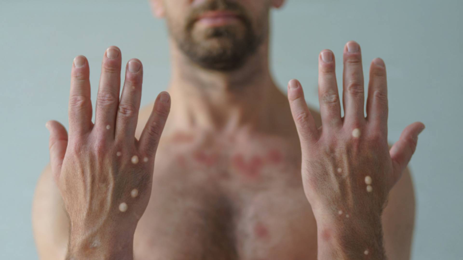 كوادر طبية في مطار لبنان