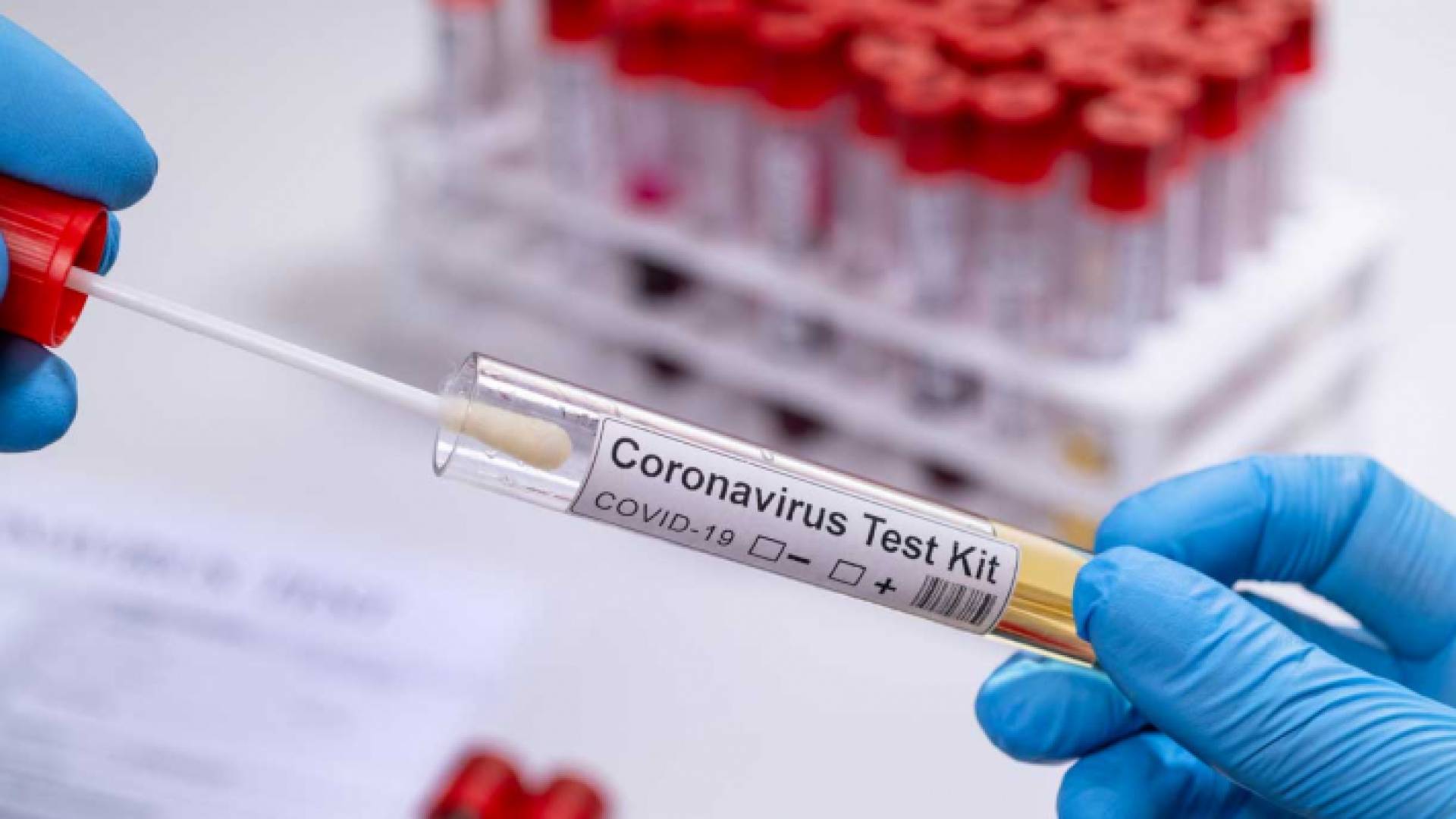 فحوص كورونا