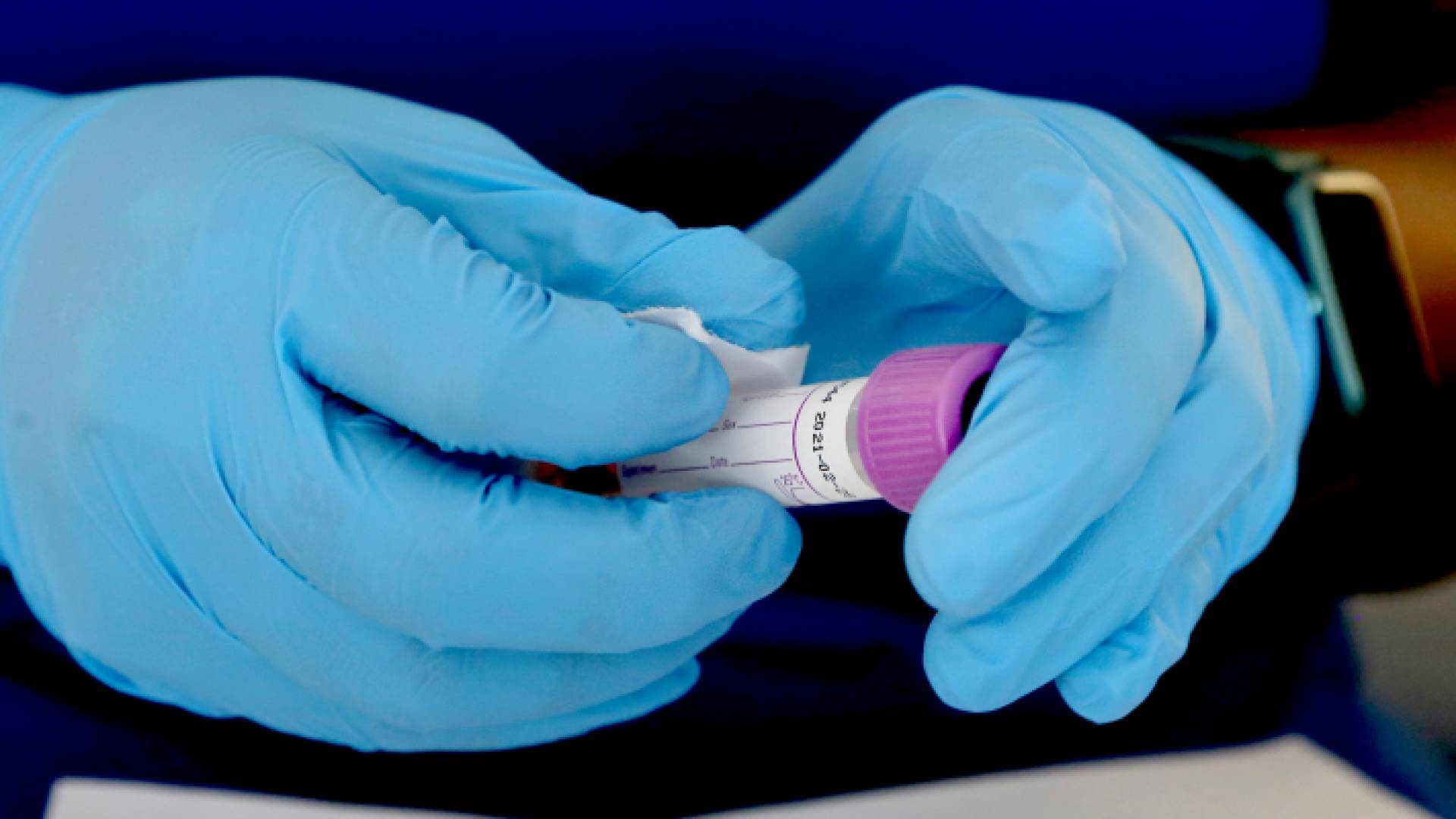 عينة فحص "بي سي آر"