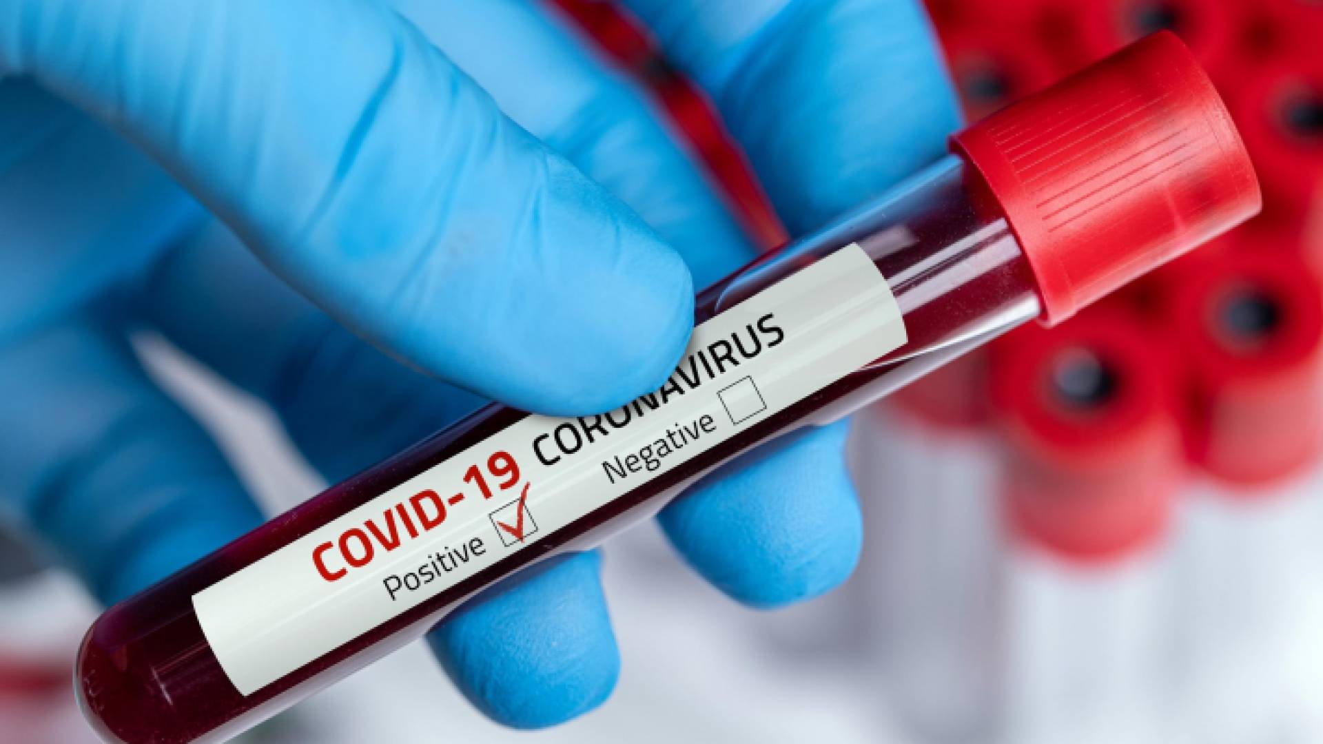 عينة فحص "بي سي آر"