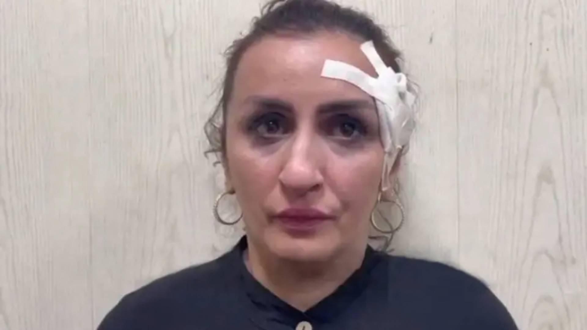 الأم الروسية التي باعت طفلها مقابل إجراء عملية تجميل لأنفها