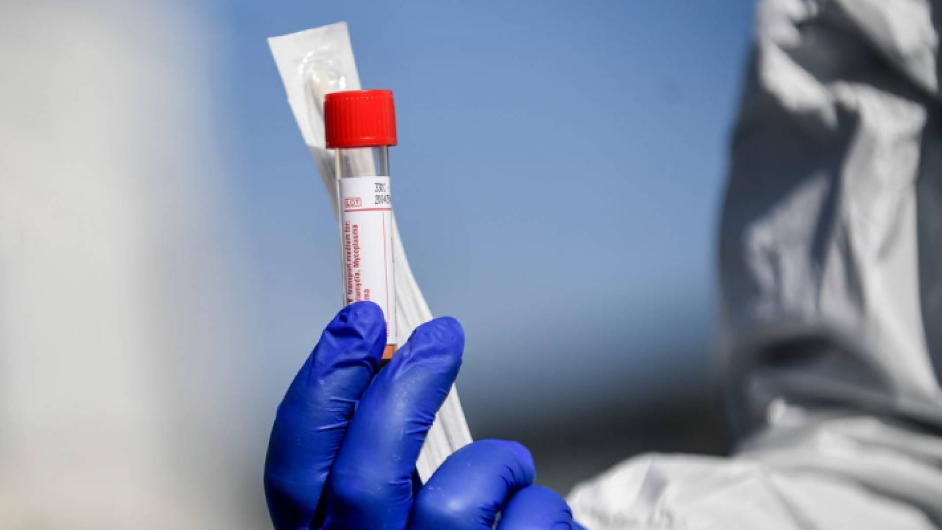 عينة فحص "بي سي آر"