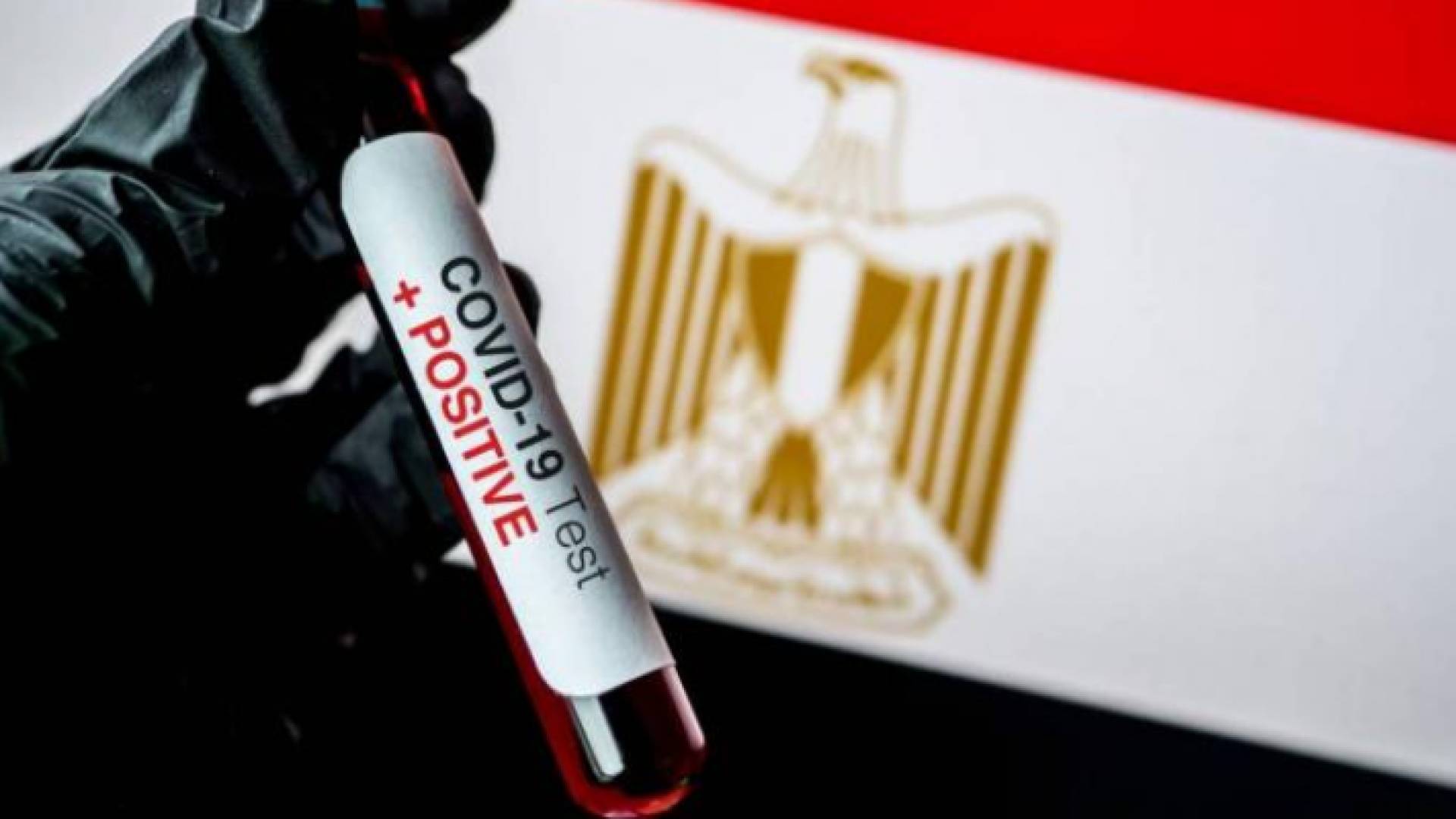 عينة من فحص كورونا