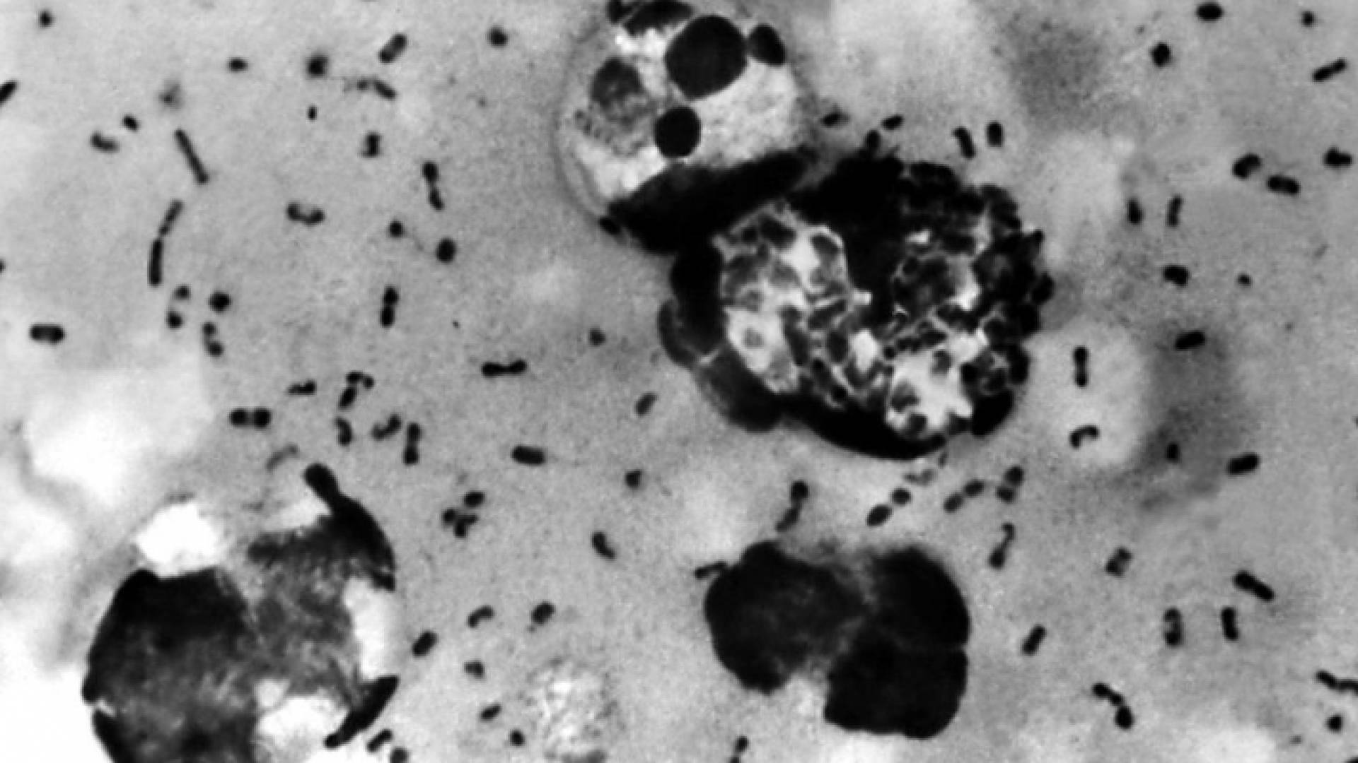 صورة تعبيرية للطاعون الدبلي