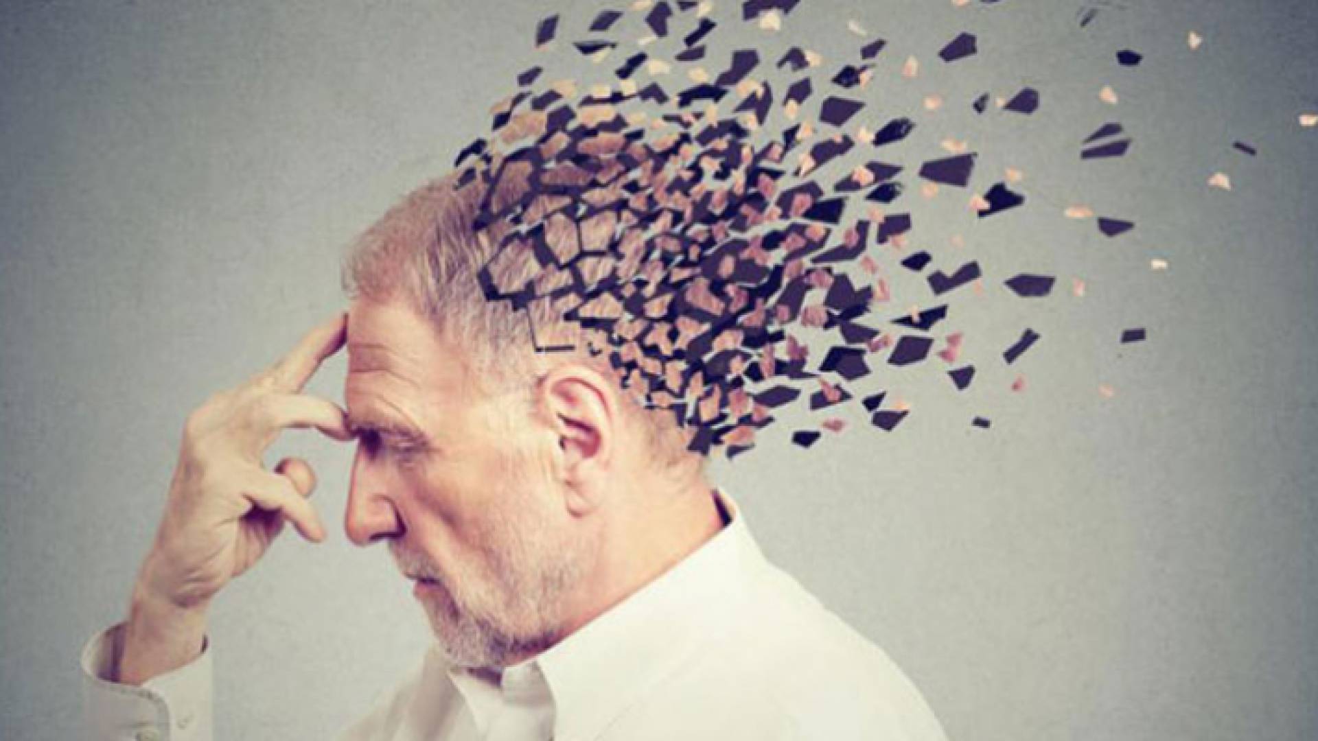 صورة تعبيرية لشخص مصاب بمرض الزهايمر