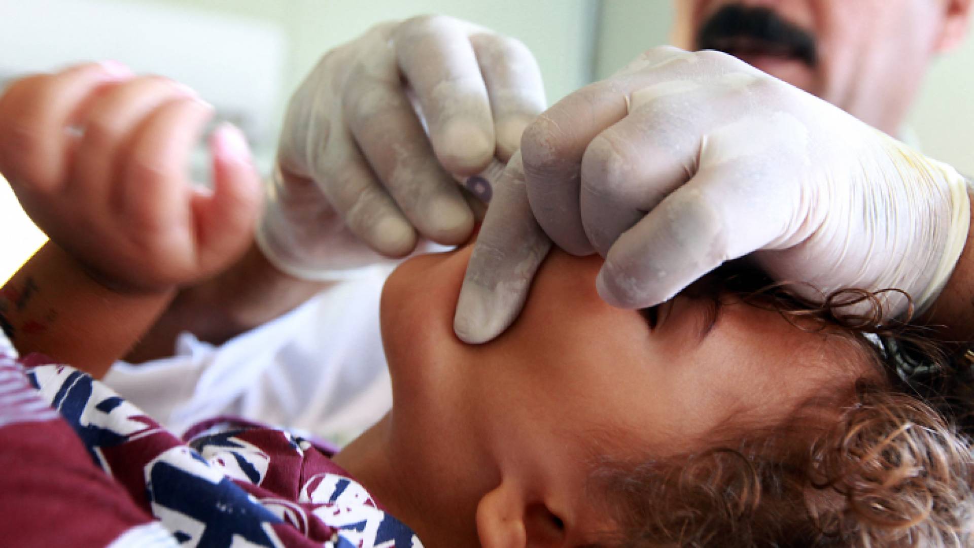 طفل عراقي يتلقى مطعوم الكوليرا