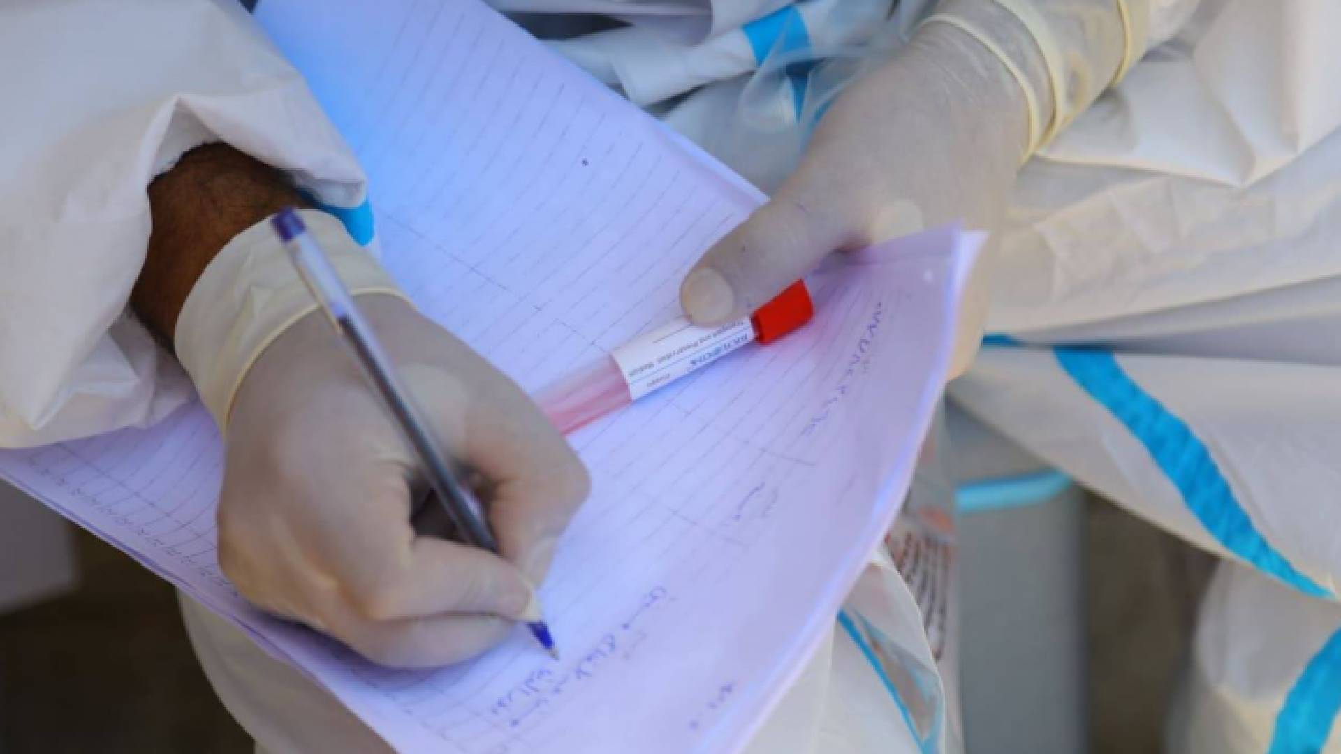 عينة فحص "بي سي آر"