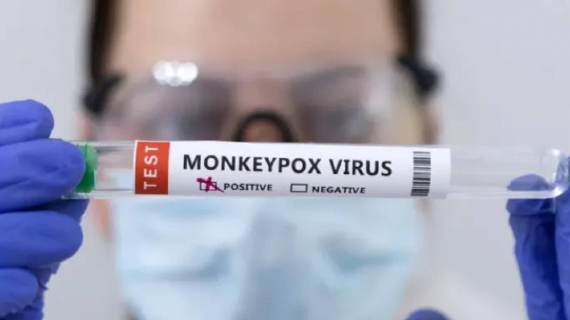 فحص لمرض جدري القرود