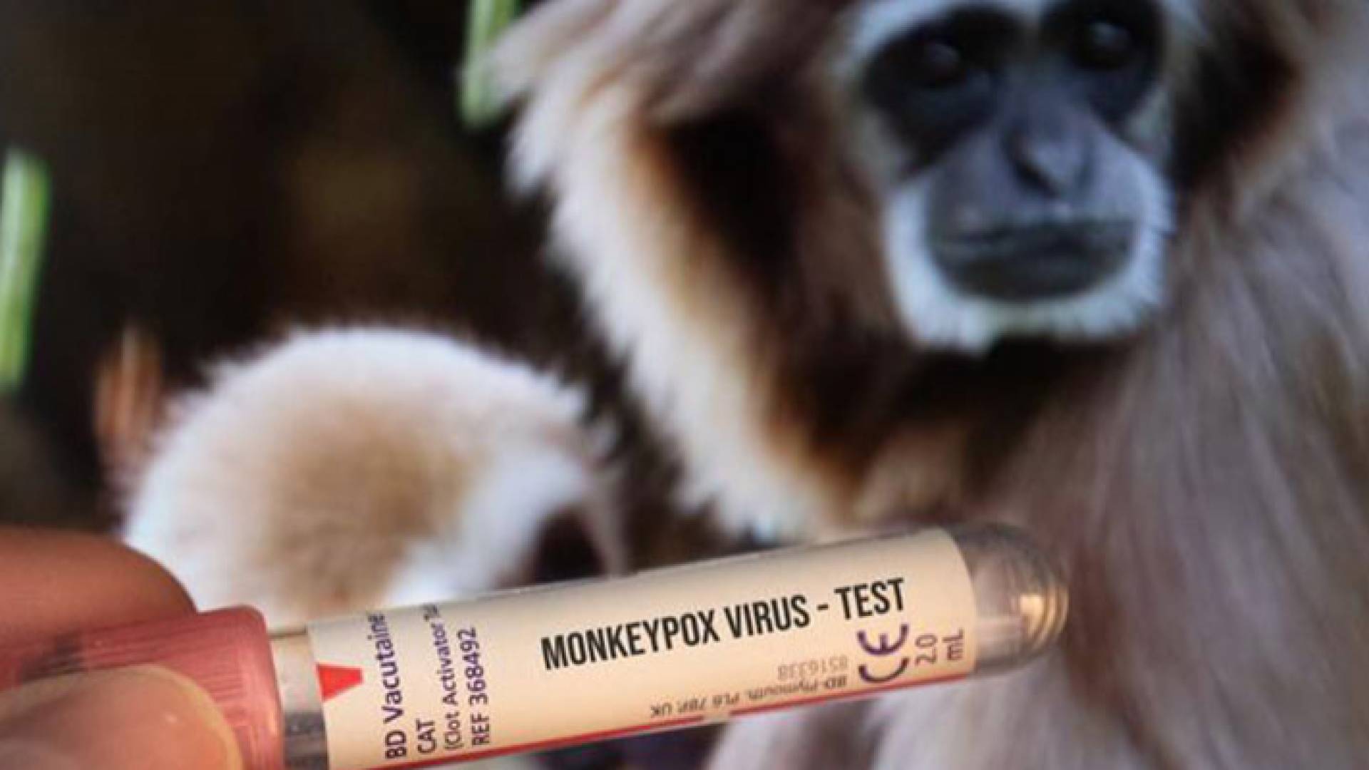 صورة تعبيرية للقاح جدري القرود