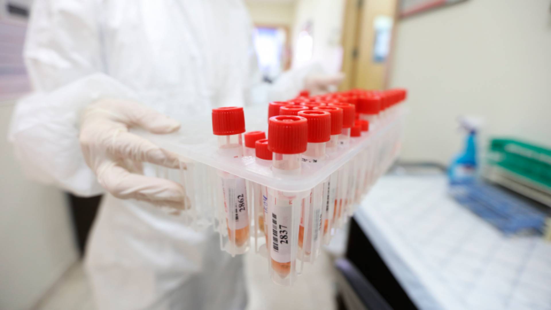 فحوص كورونا