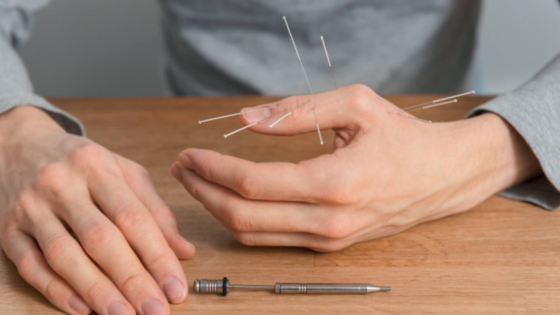 وخز بالابر الصينية