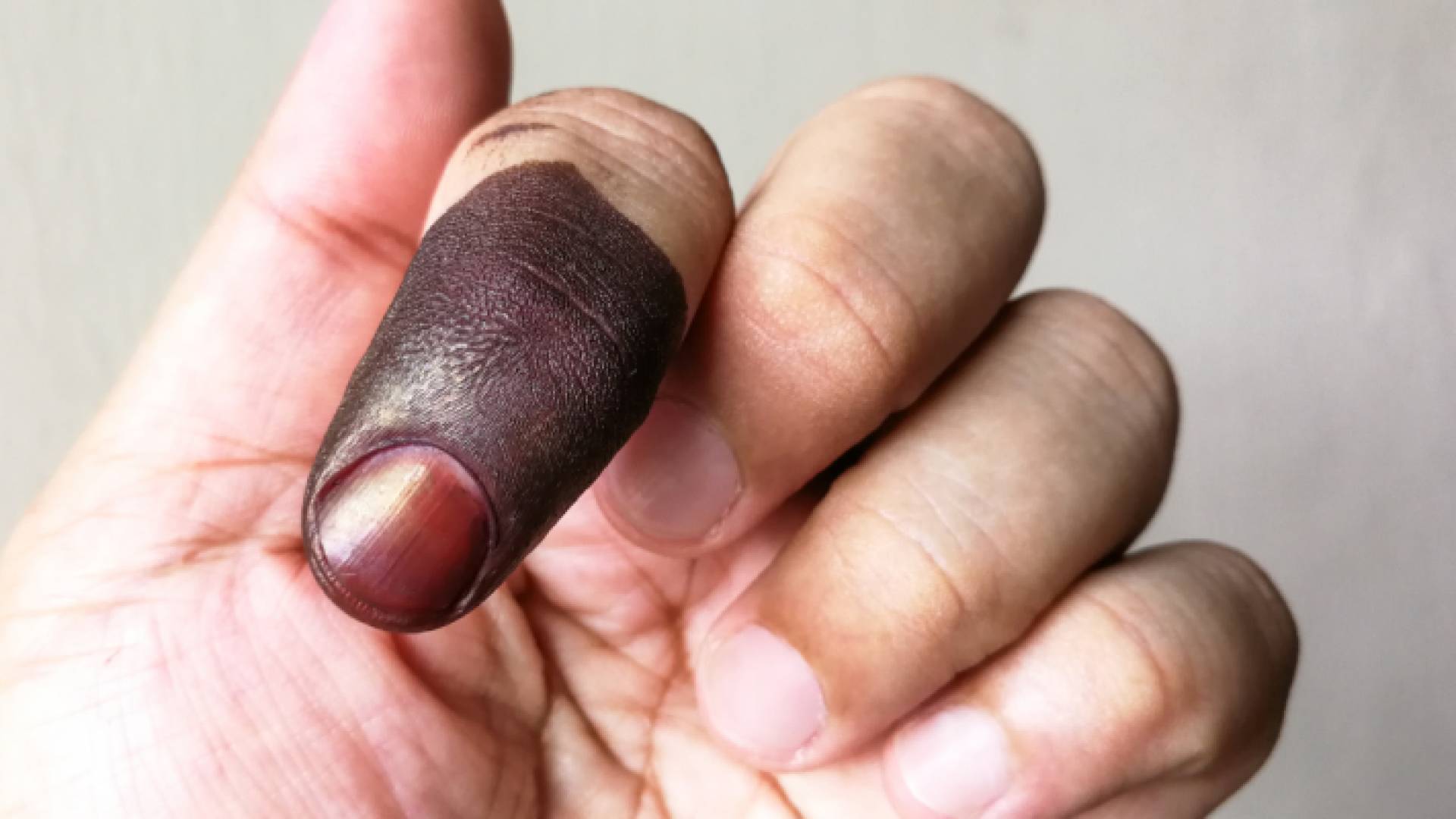 حبر مخصص للانتخابات