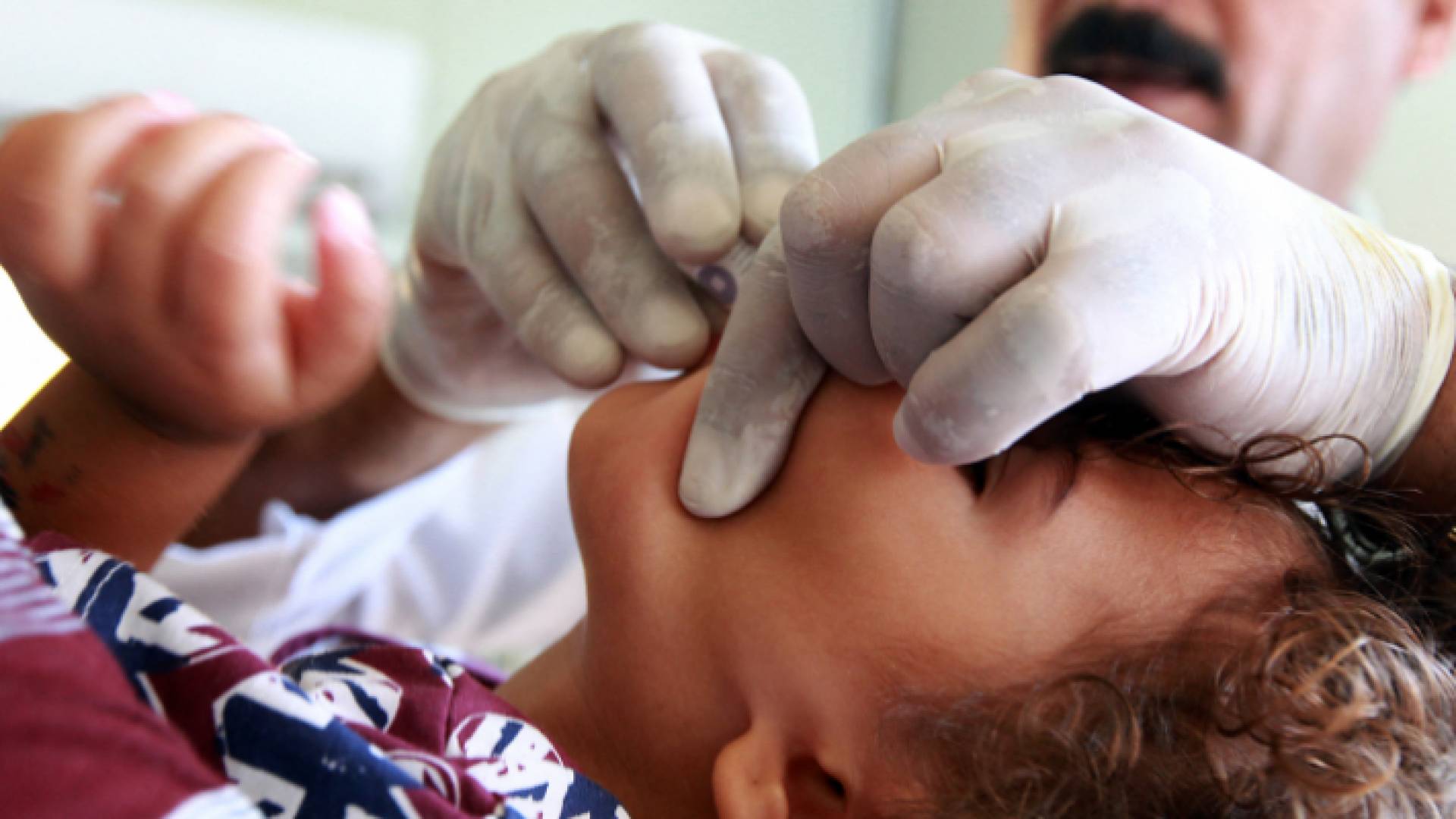 طفل يتلقى مطعوم الكوليرا - أرشيفية