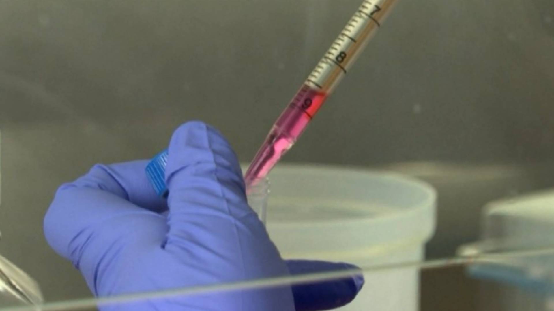 لقاح كورونا