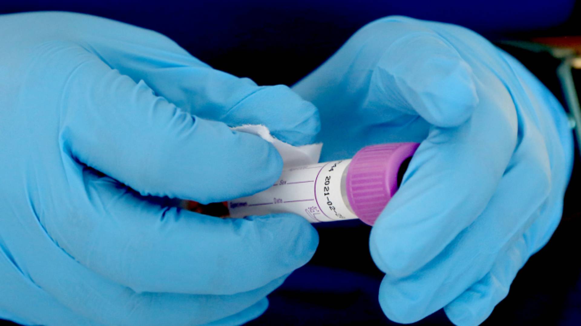 صورة توضيحية