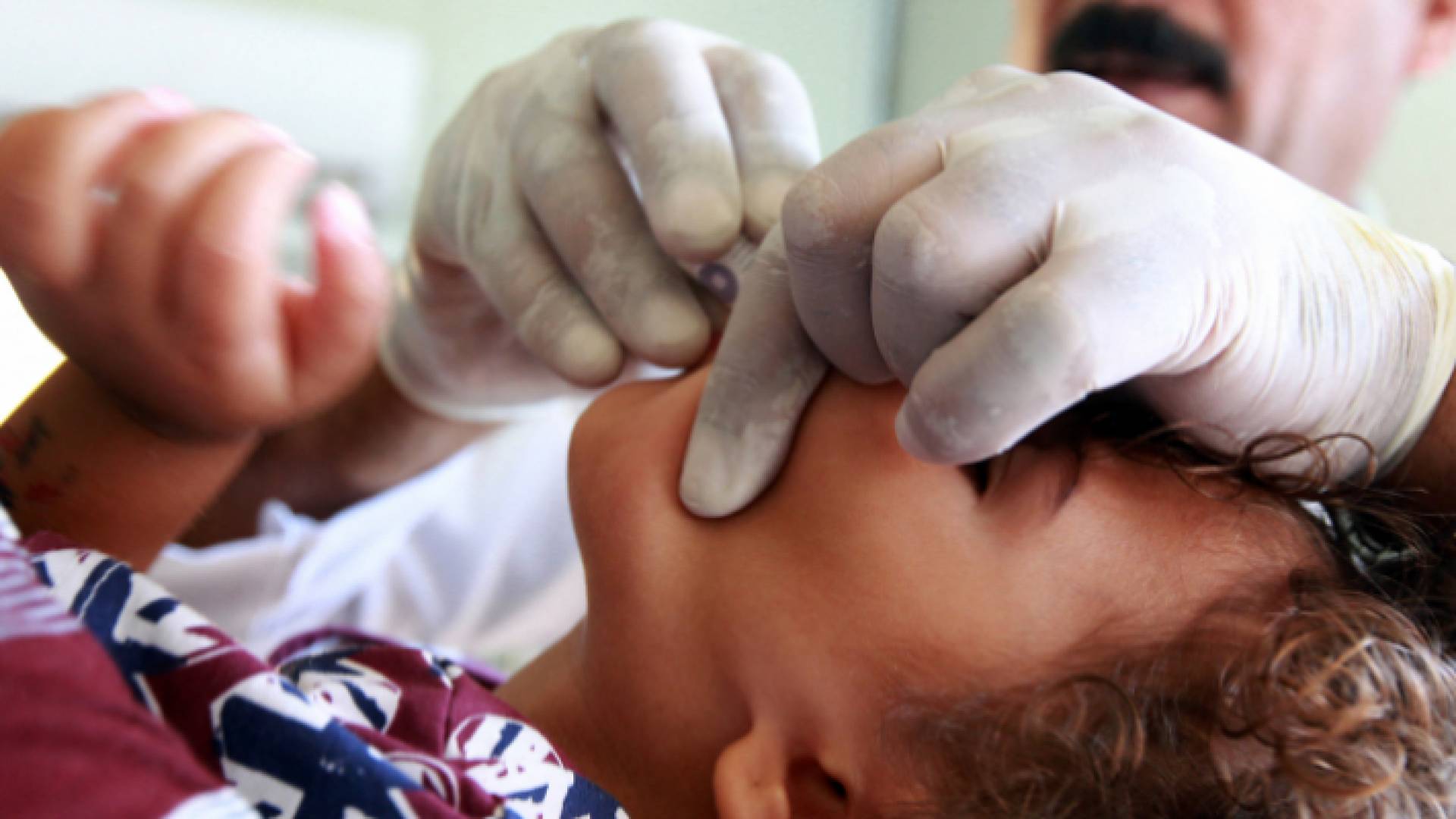 طفل يتلقى مطعوم الكوليرا - أرشيفية