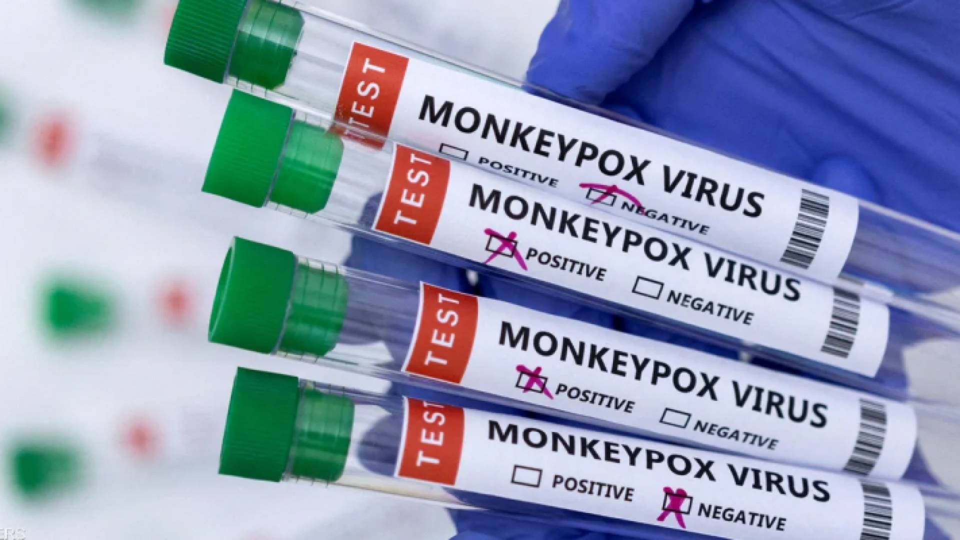 فحوص لمرض جدري القرود