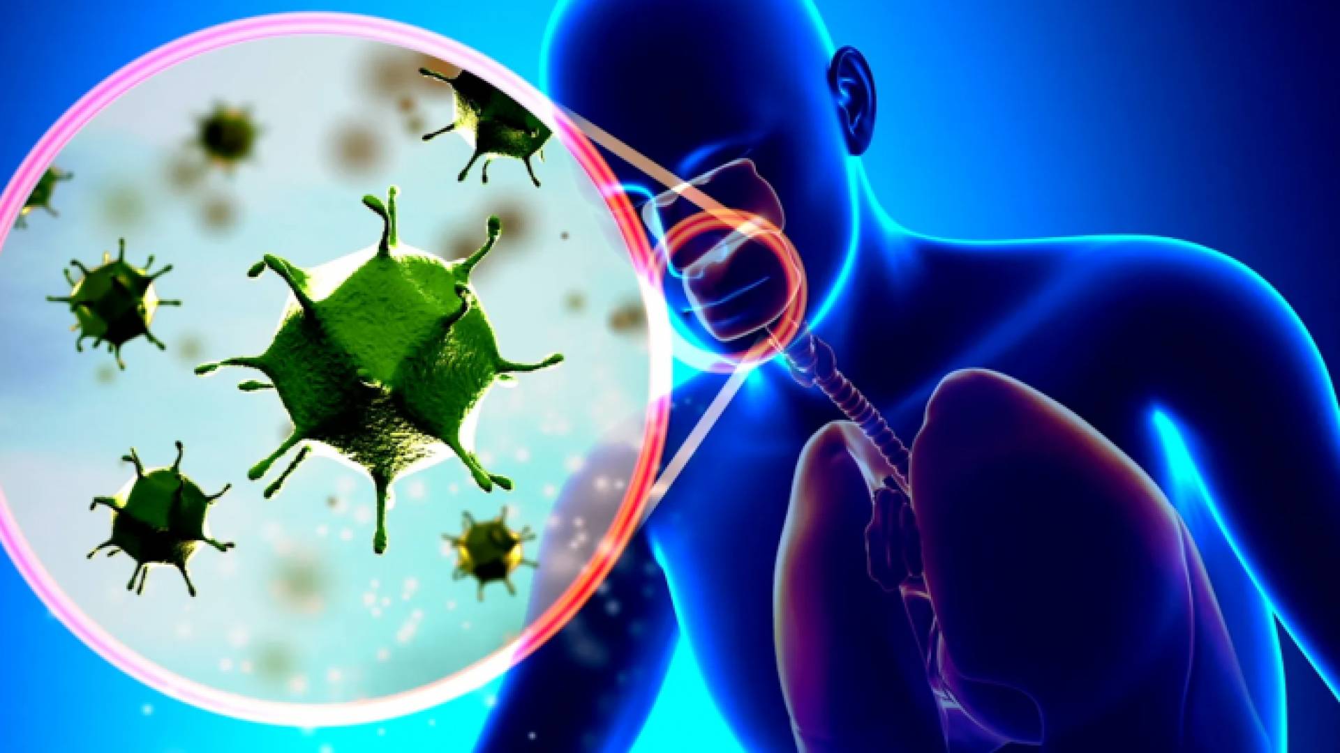 صورة توضيحية للإصابة بفيروس الإنفلونزا