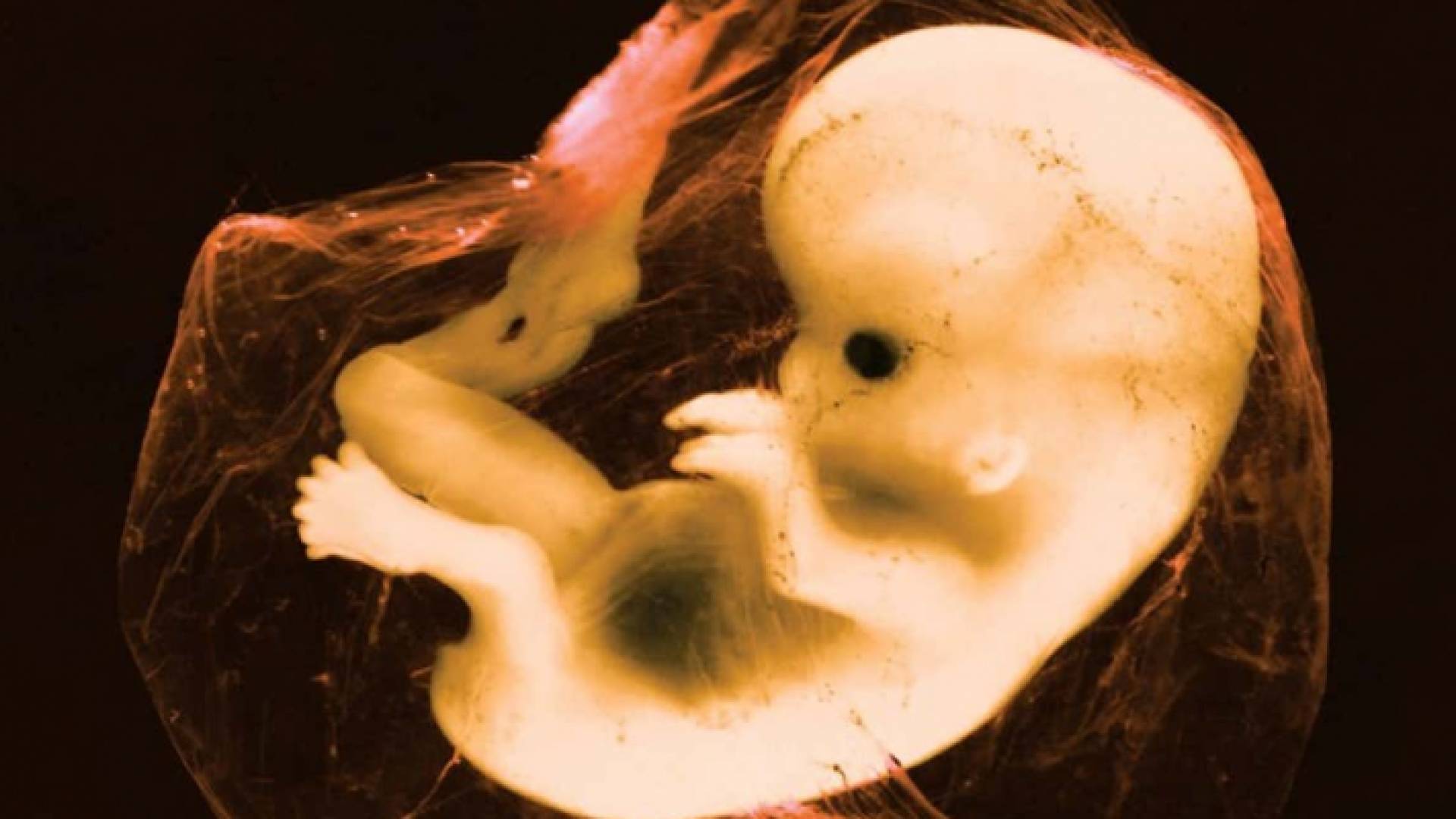 صورة تعبيرية لجنين