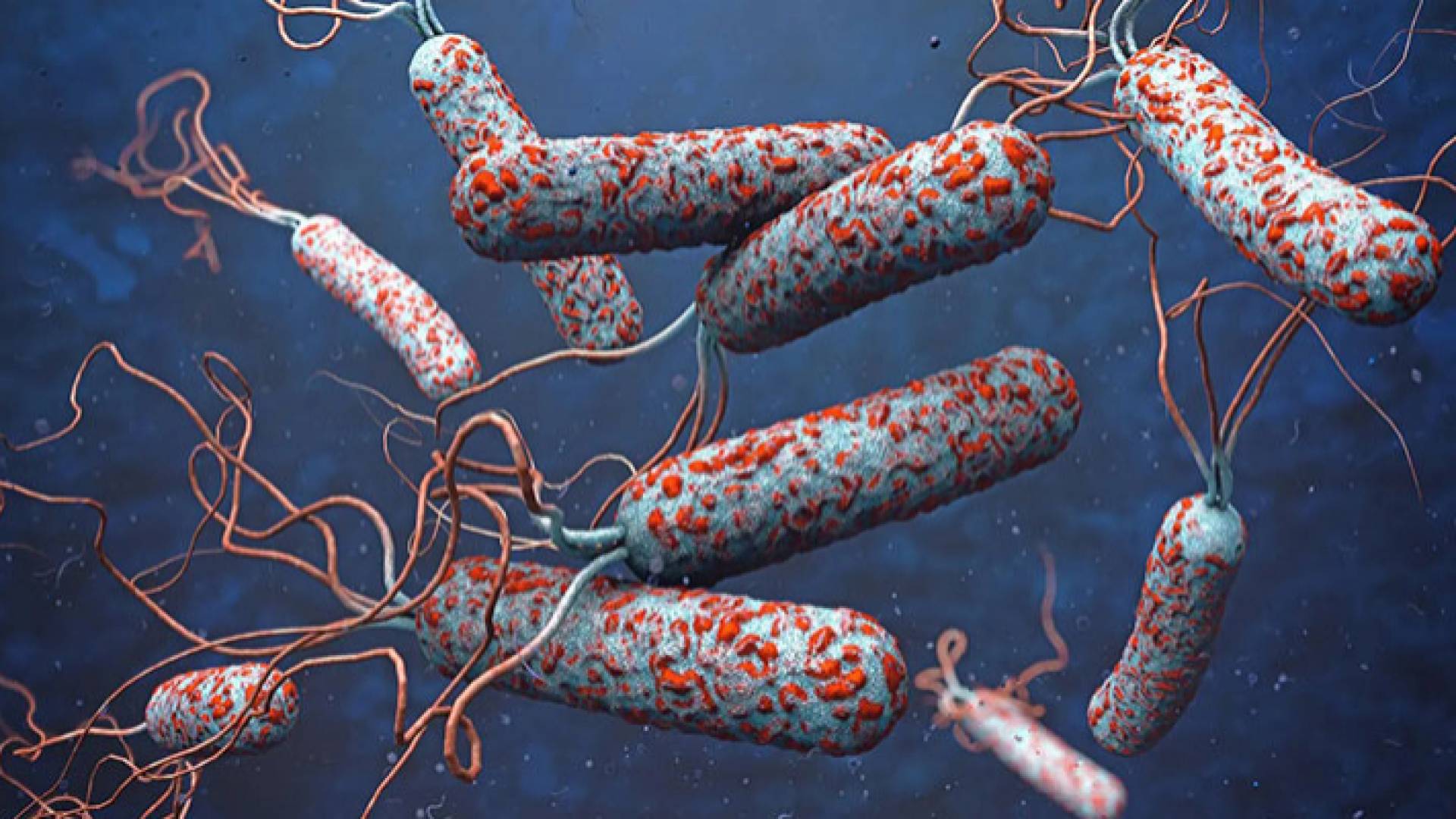 الكوليرا - تعبيرية