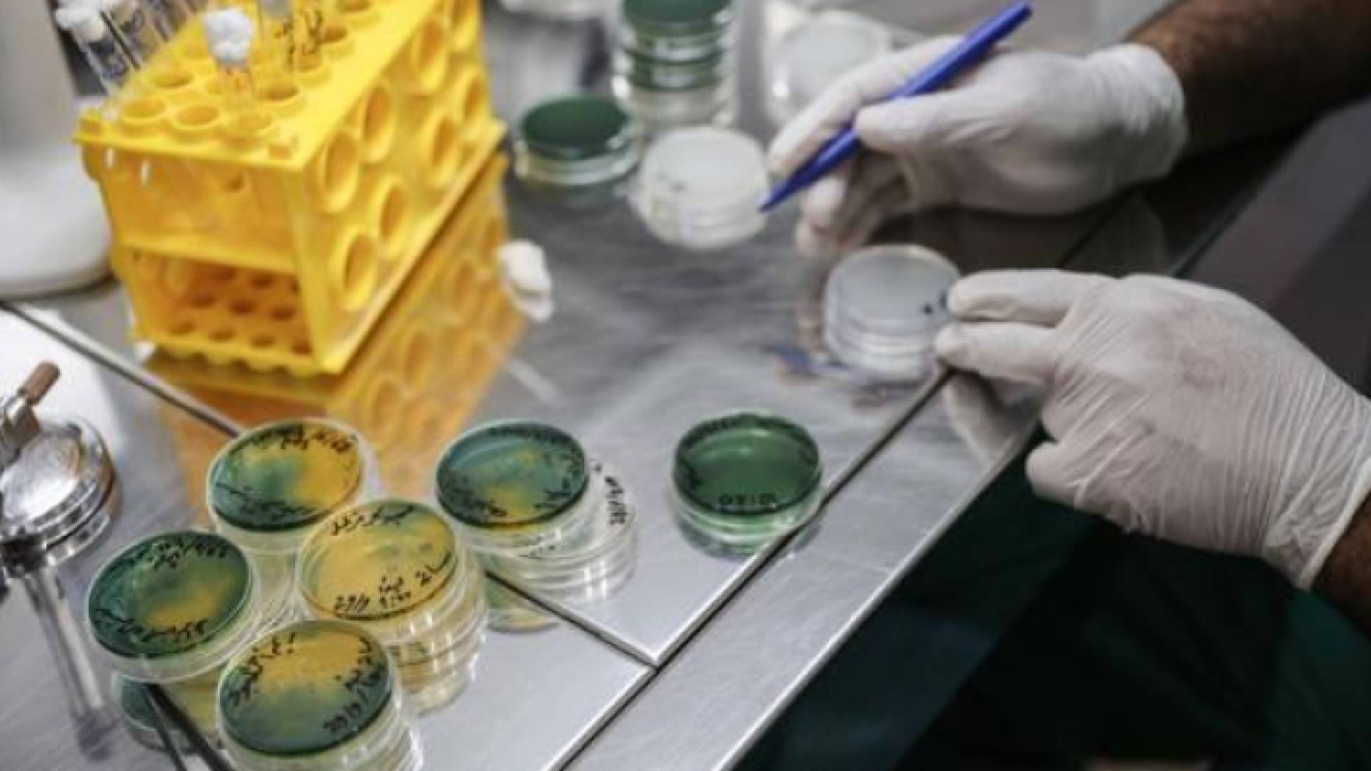 فحوص خاصة بمرض الكوليرا