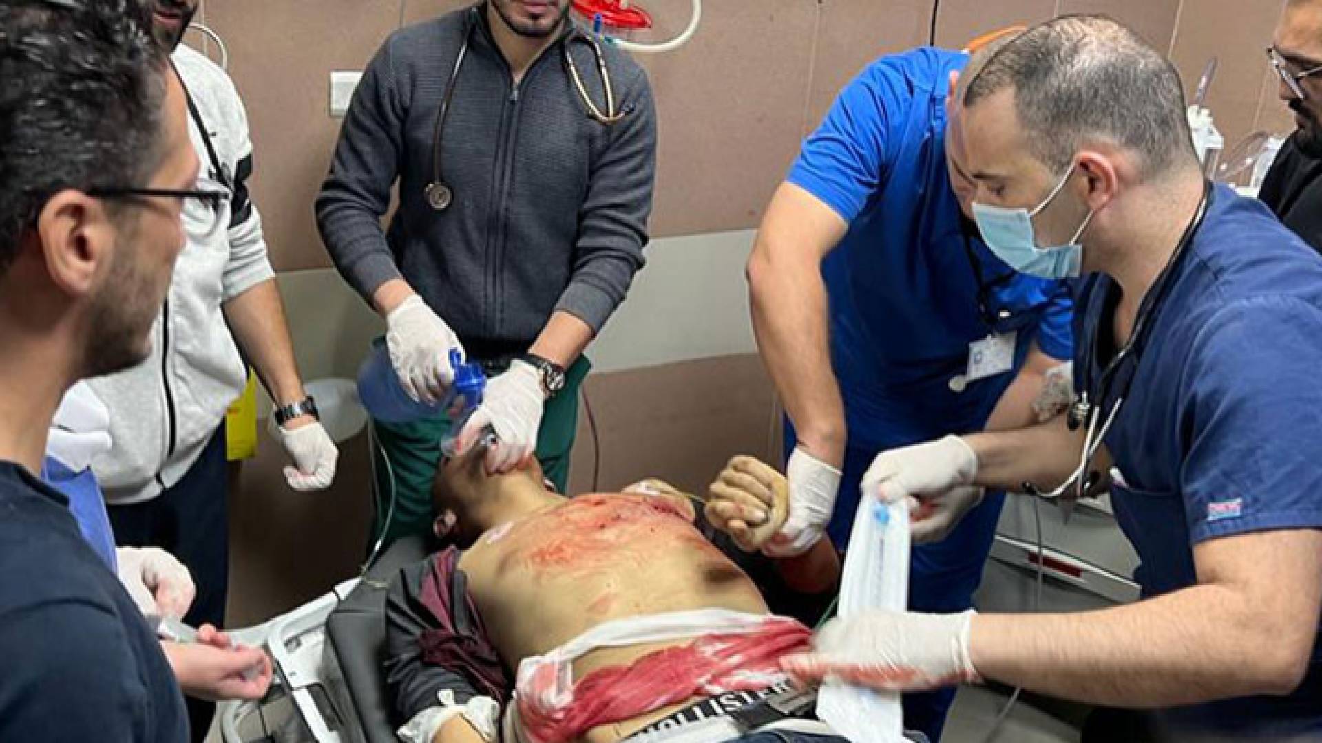 محاولات إنعاش الشاب المصاب برصاص الاحتلال الإسرائيلي في منطقة القلب