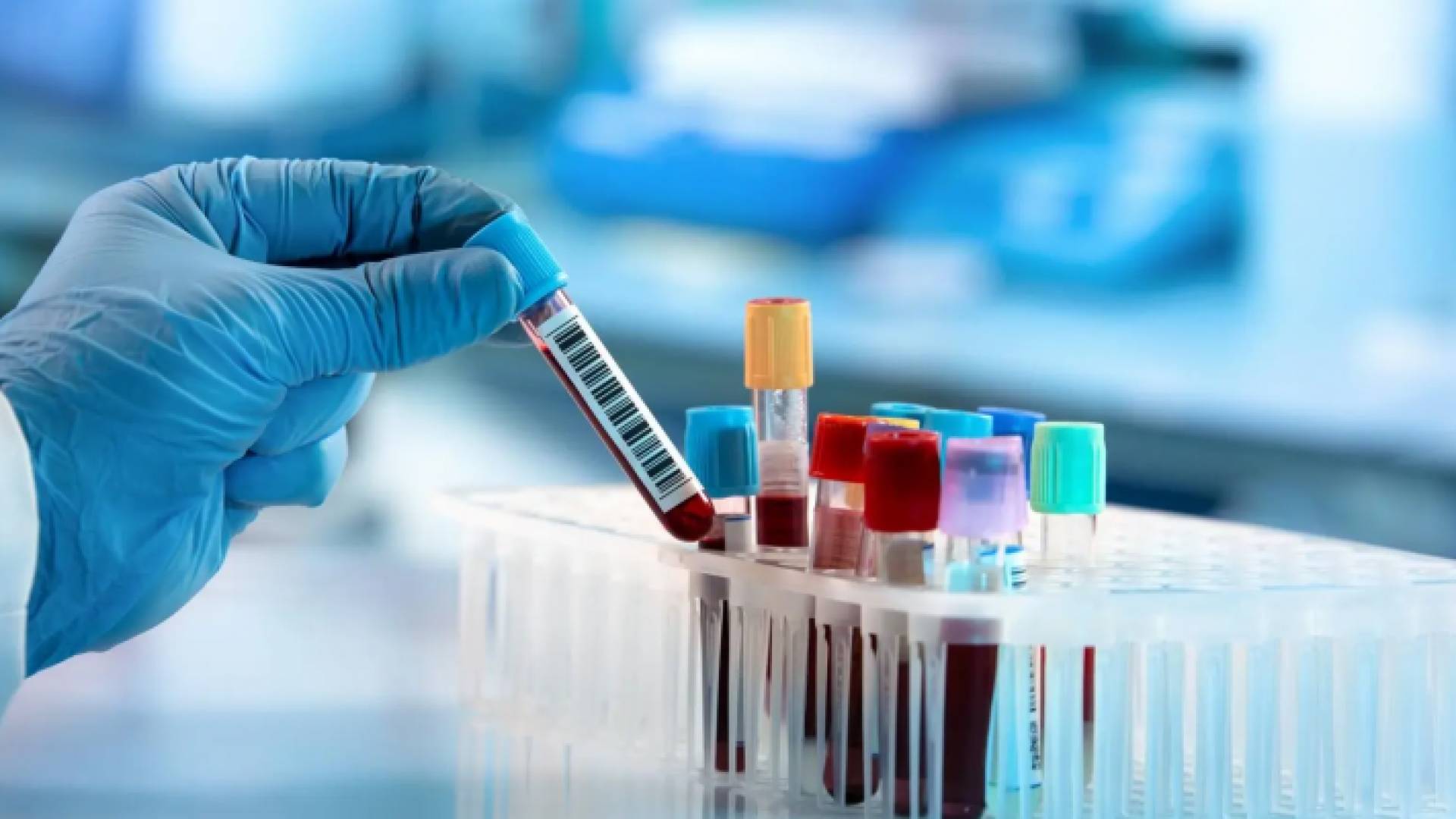 فحوص في أحد المختبرات