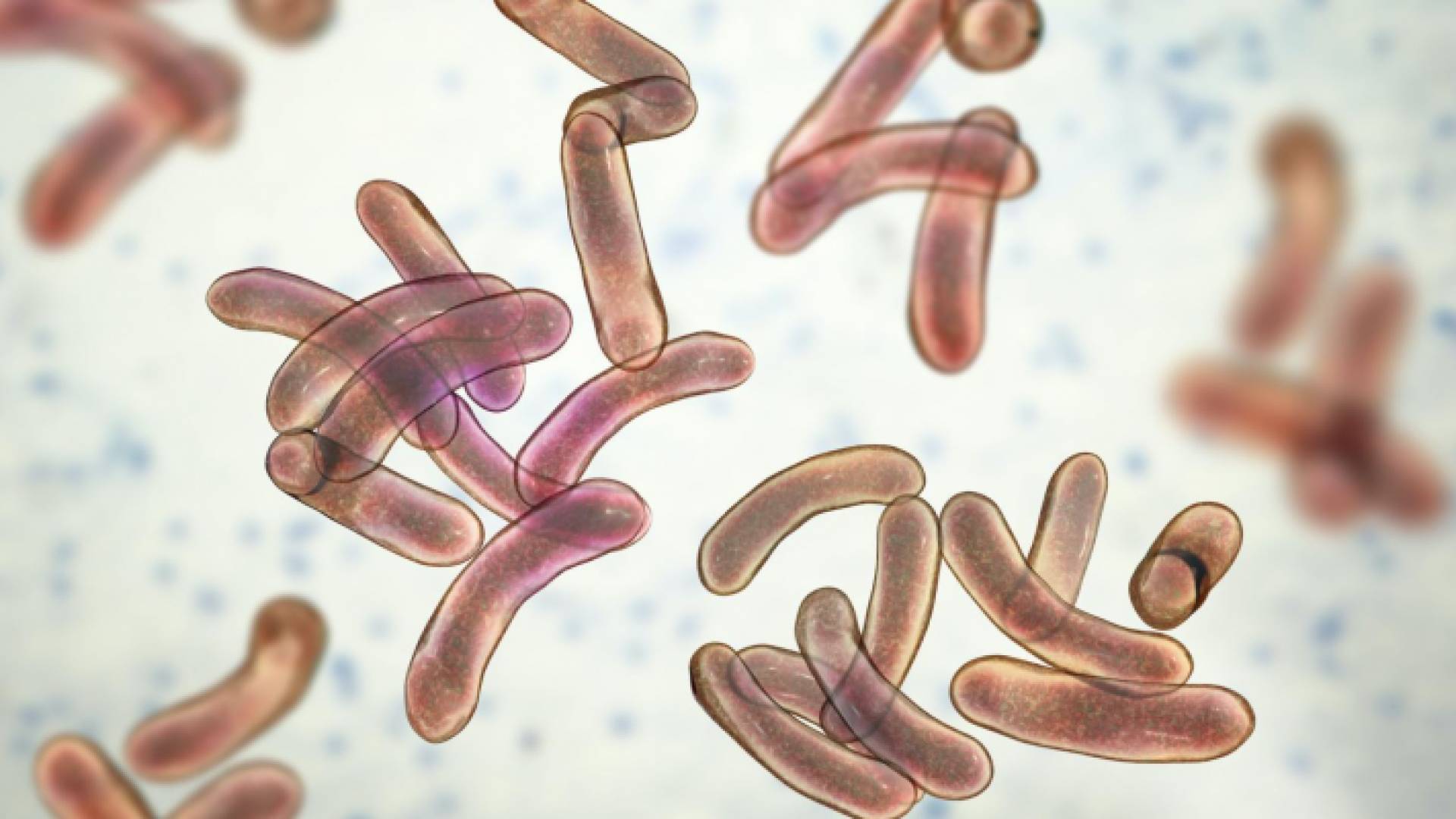 الكوليرا- تعبيرية