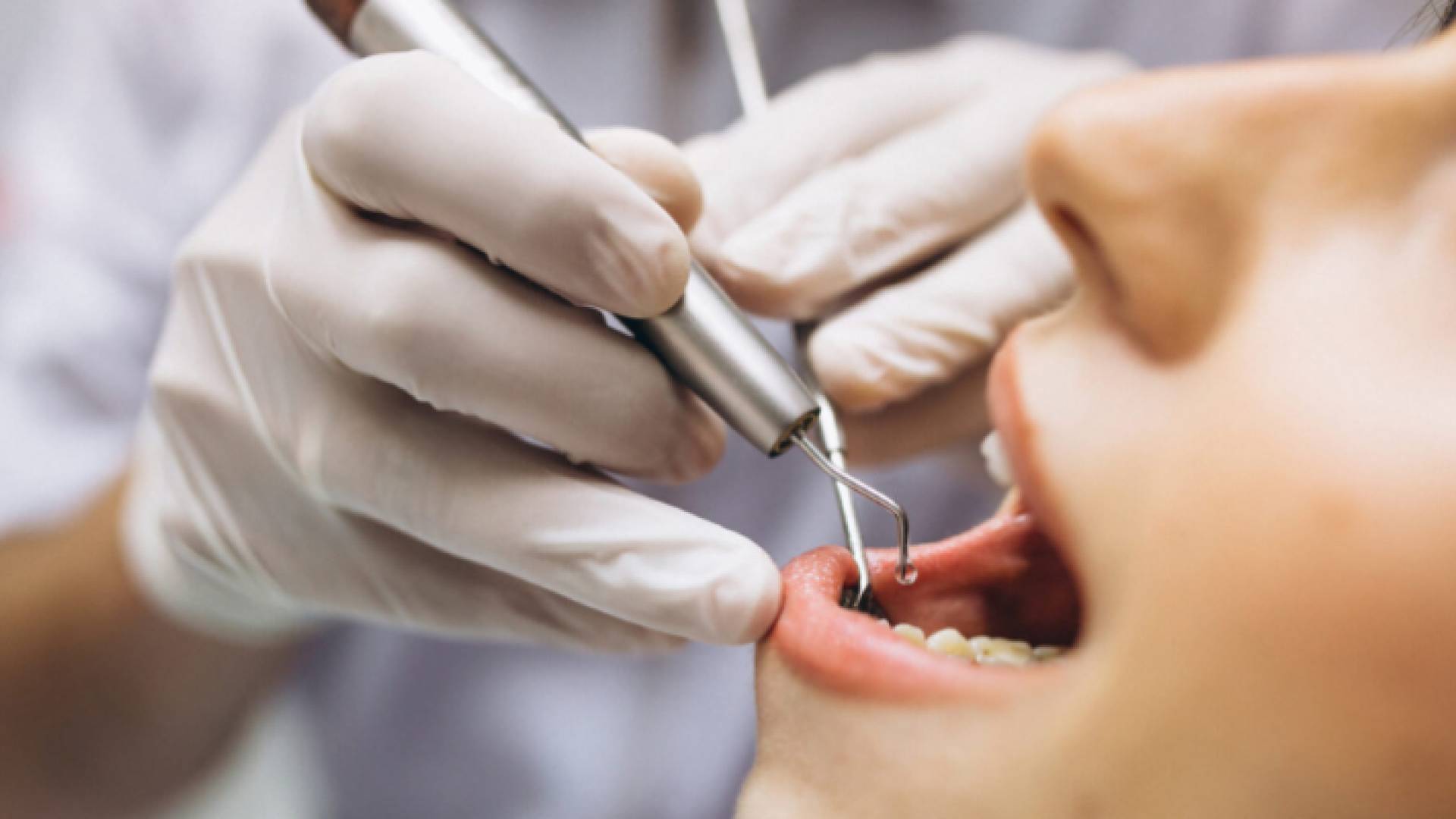 صورة توضيحية لطبيب يعالج أسنان إحدى المريضات