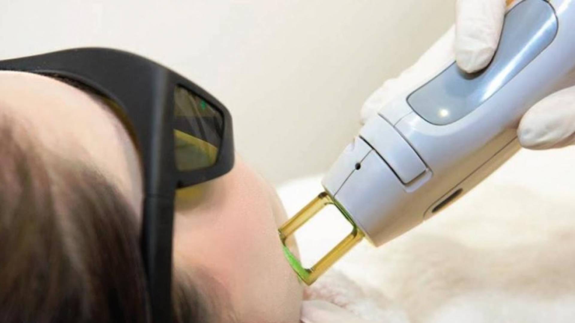 جهاز ليزر - تعبيرية