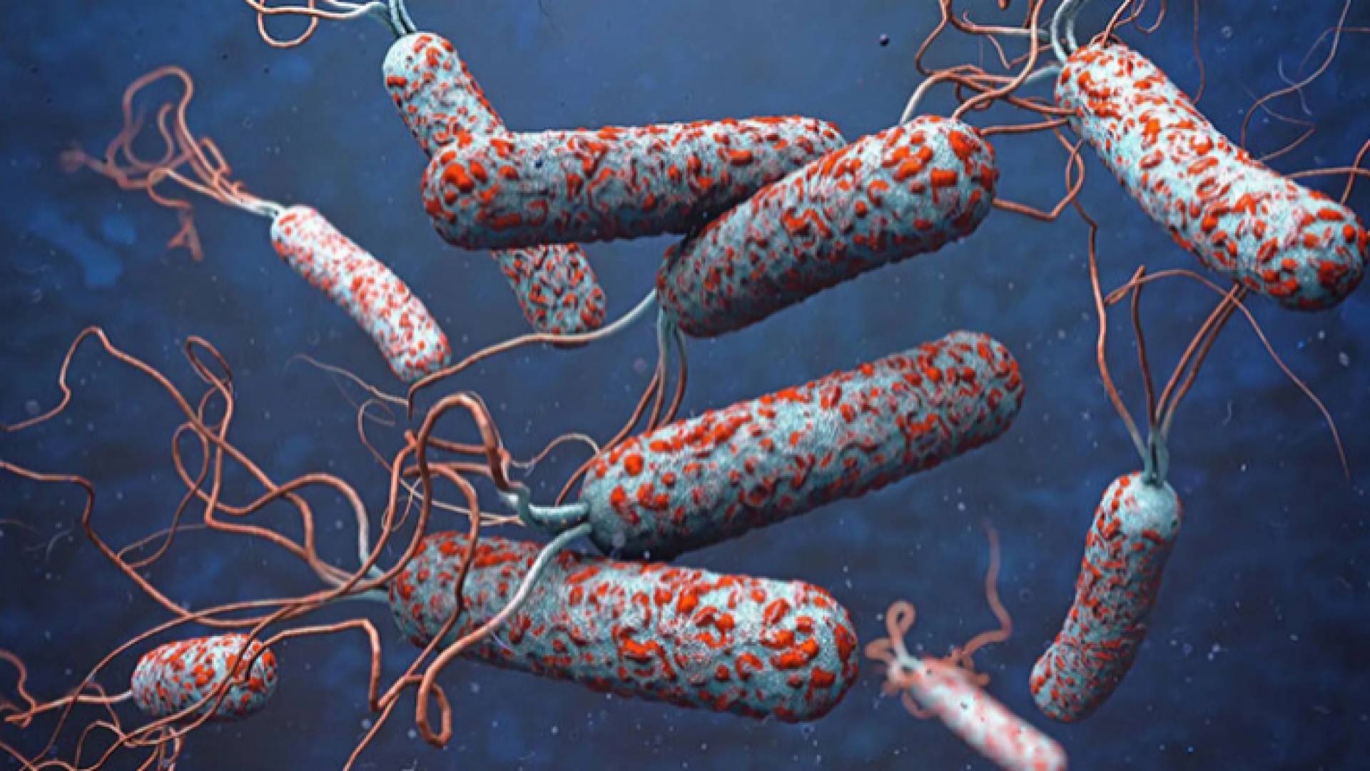 صورة تعبيرية لمرض الكوليرا