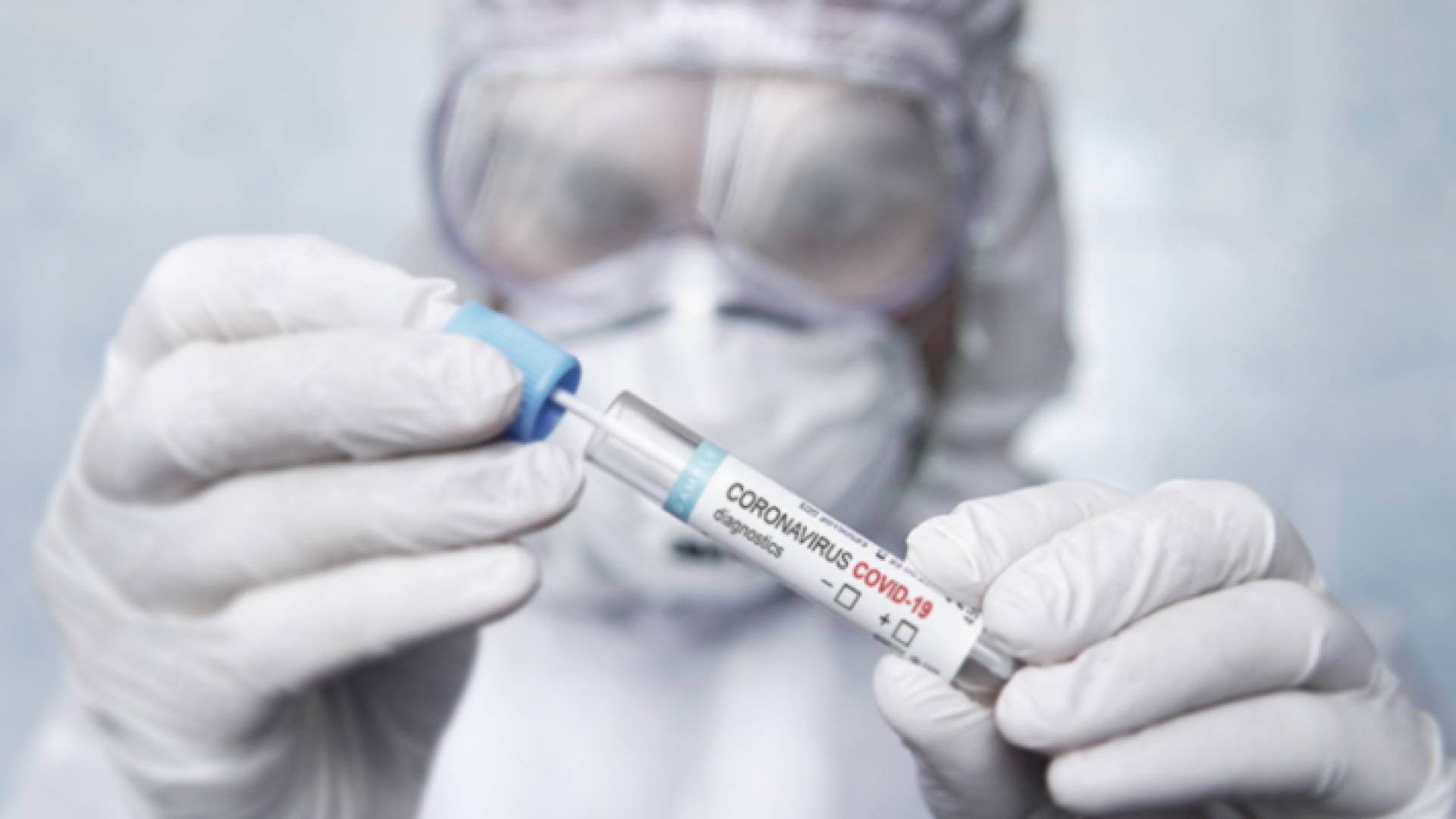 اختبارات كوفيد