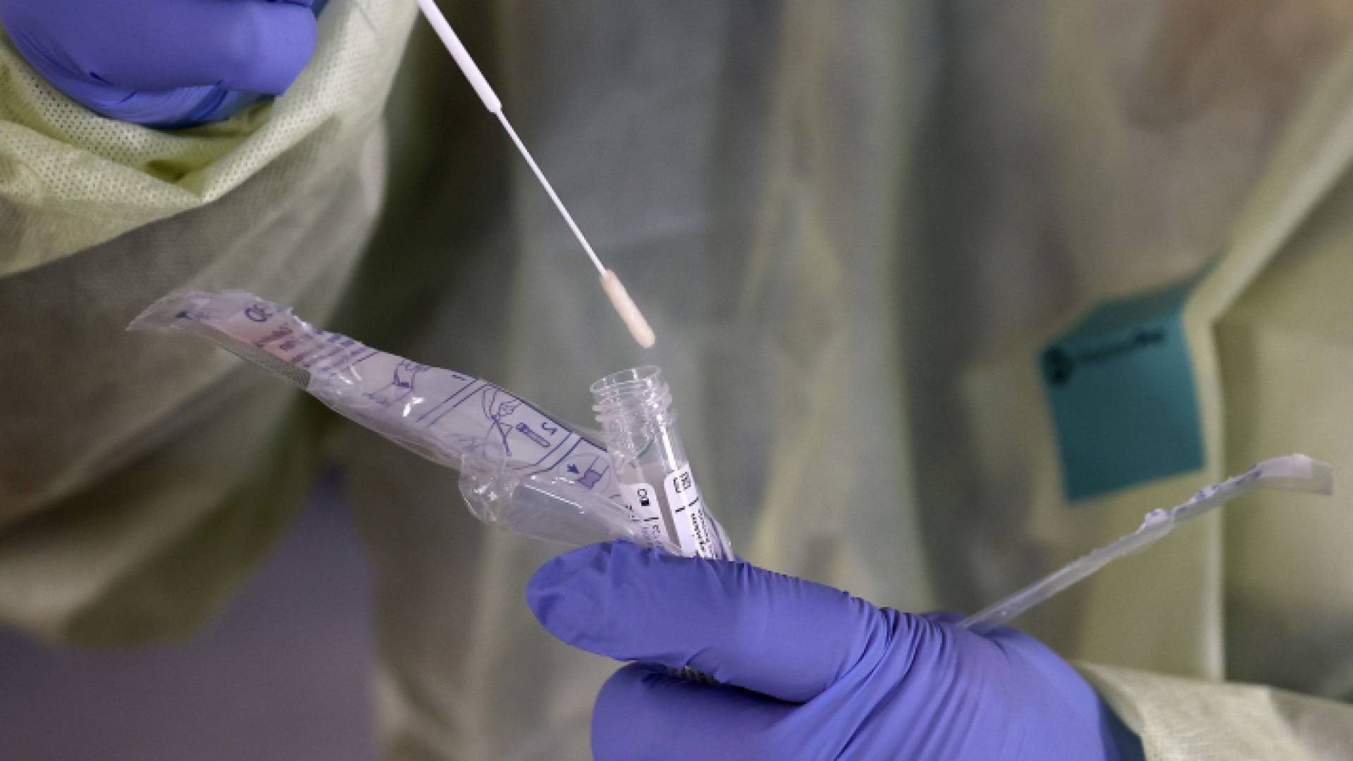 فحص الكشف عن فيروس كورونا