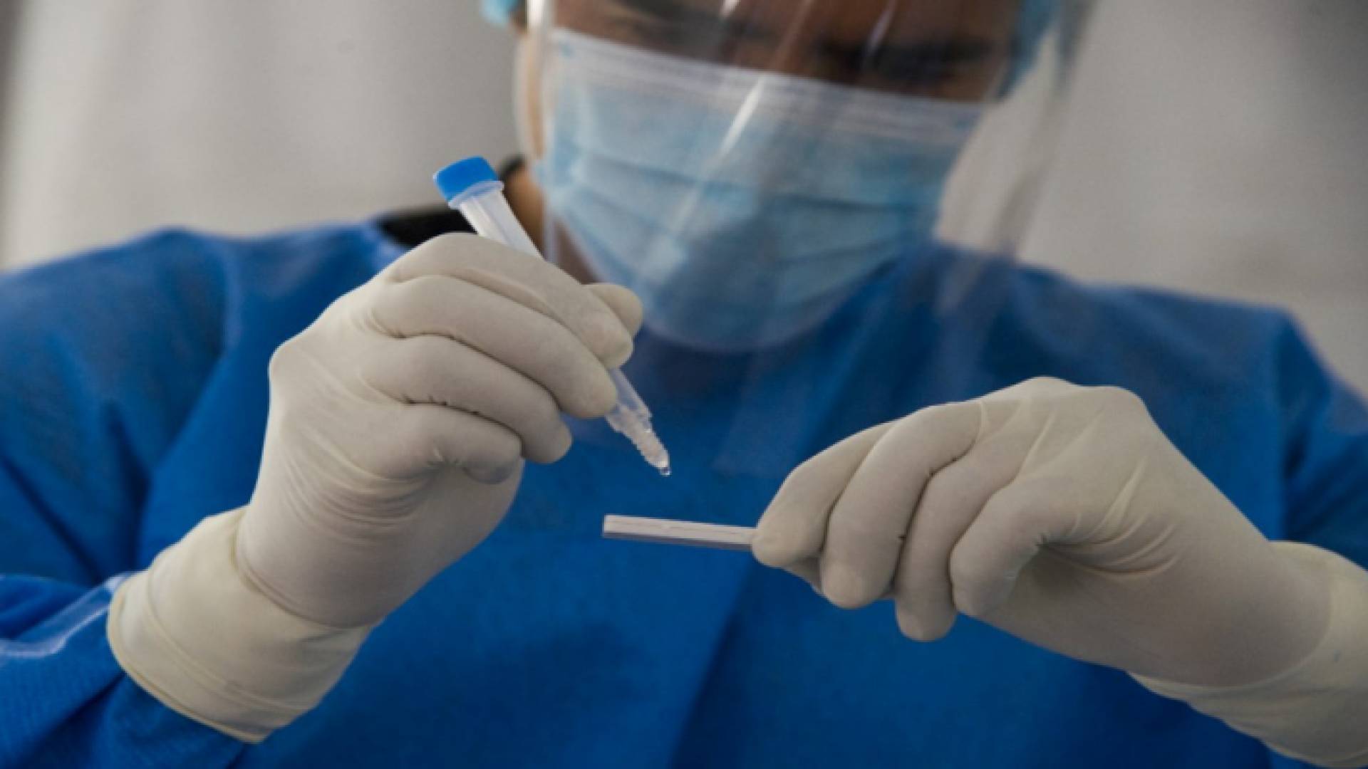 طبيب يجري فحصا للكشف عن فيروس كورونا