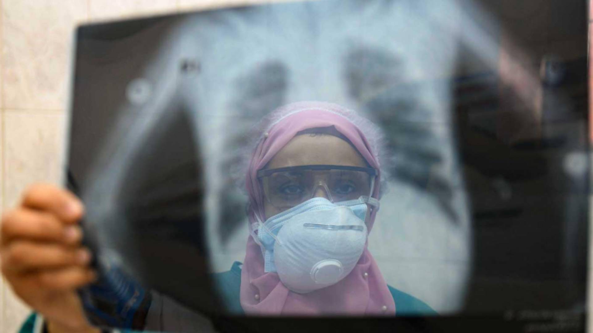 طبيبة مصرية تمسك صورة أشعة