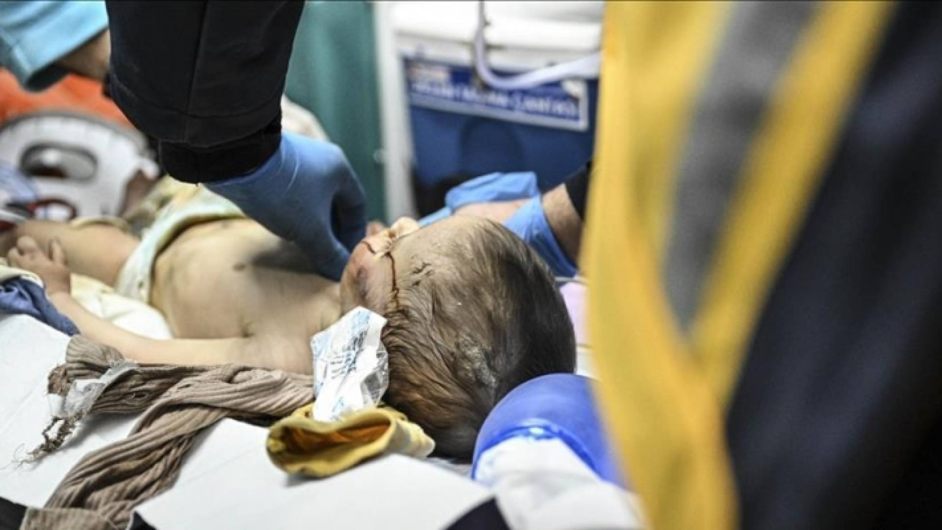 الطفل الرضيع حمزة المنقذ من تحت الأنقاض