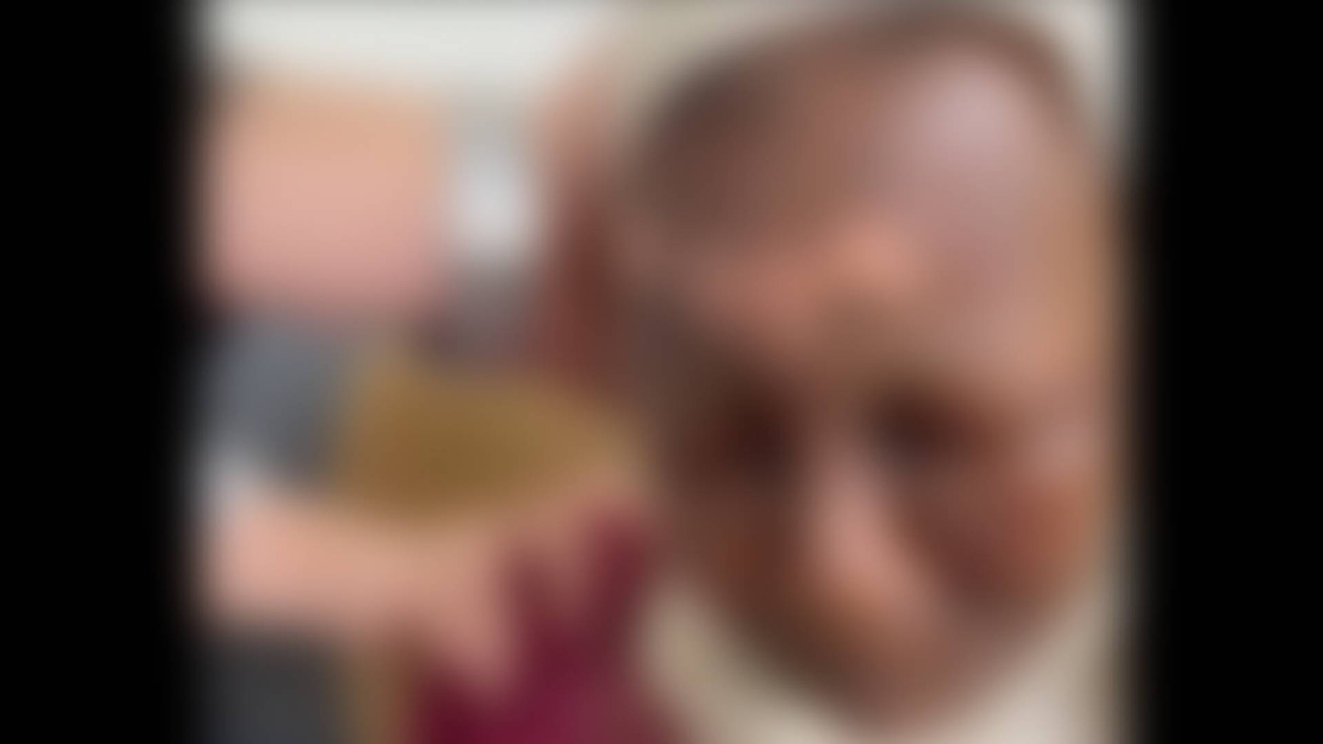 السيدة المسنة عقب تعرضها للحرق