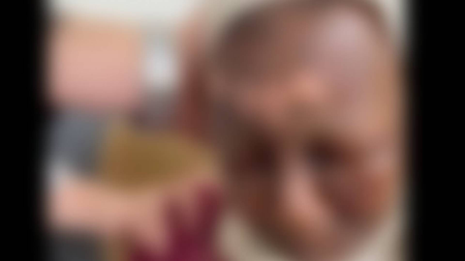 صورة للمسنة عقب تعرضها للحرق