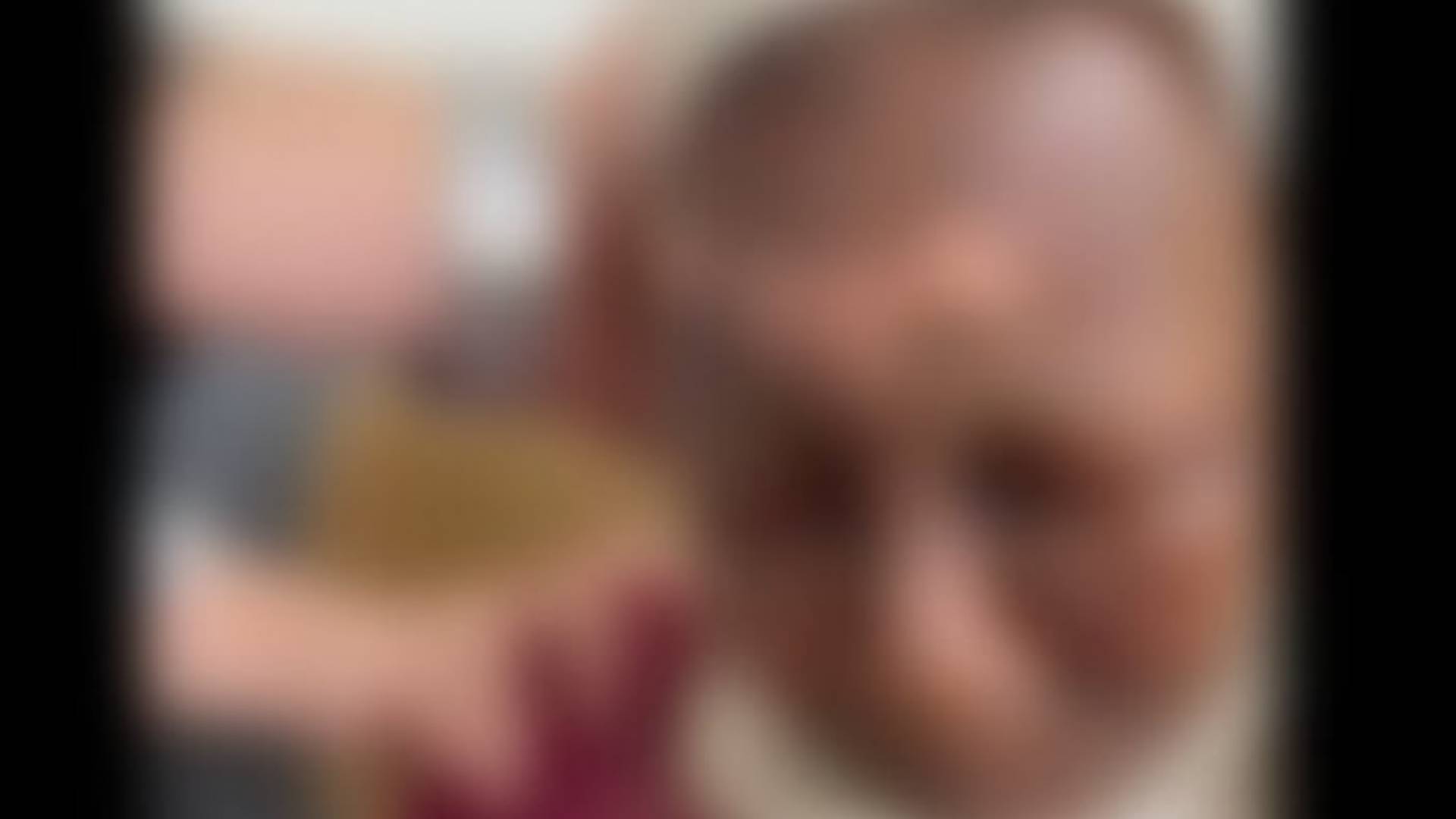 صورة للمسنة عقب تعرضها للحرق