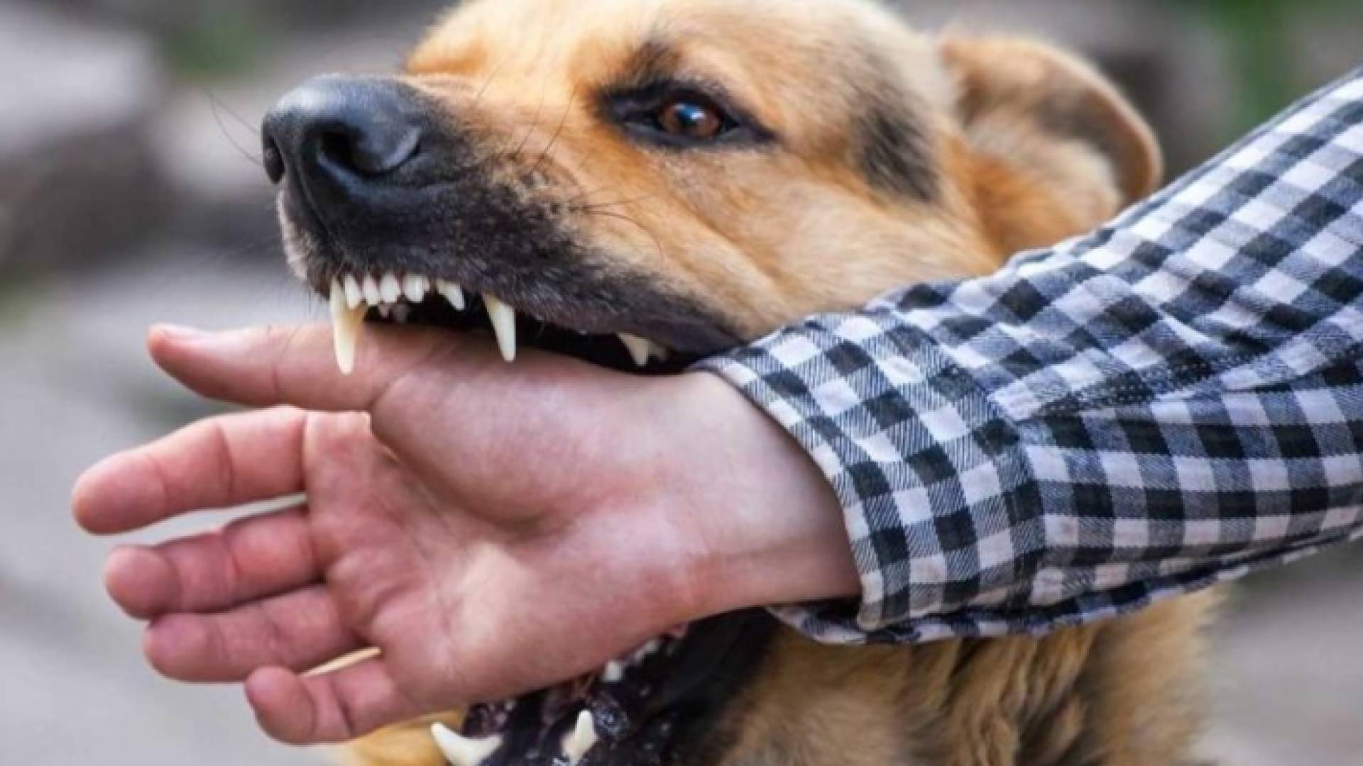 صورة تعبيرية لعقر كلب شخص بيده