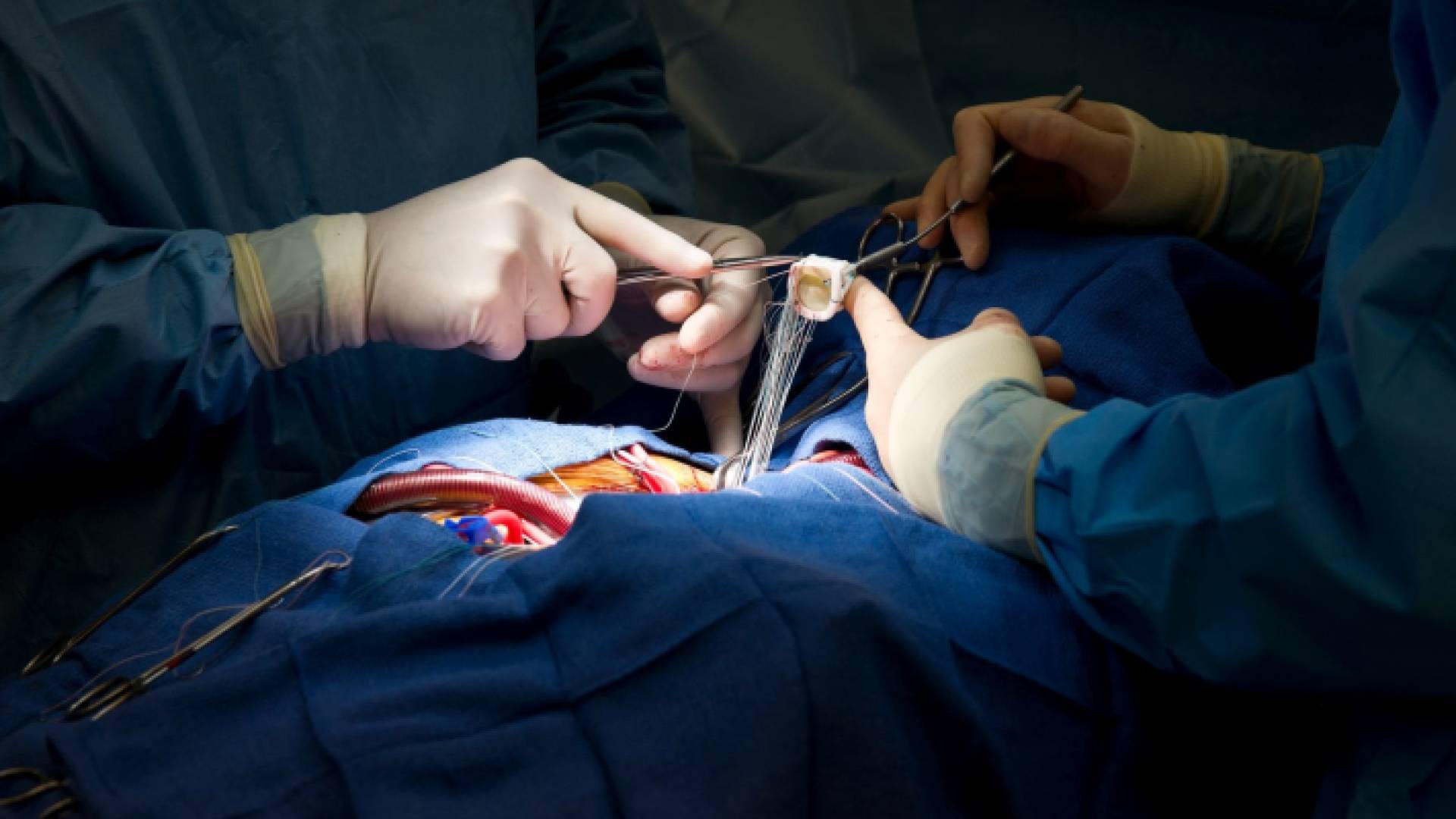 عملية جراحية