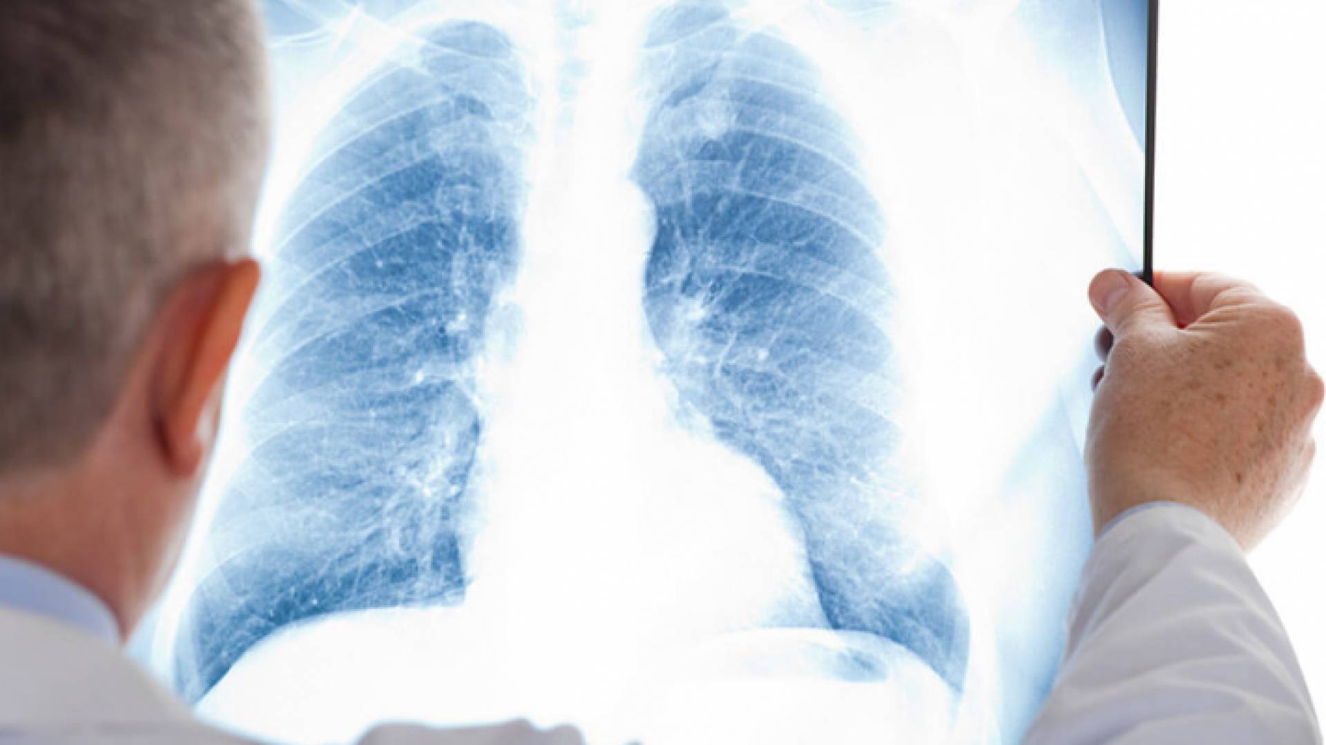 طبيب يحمل صورة أشعة لتشخيص مريض