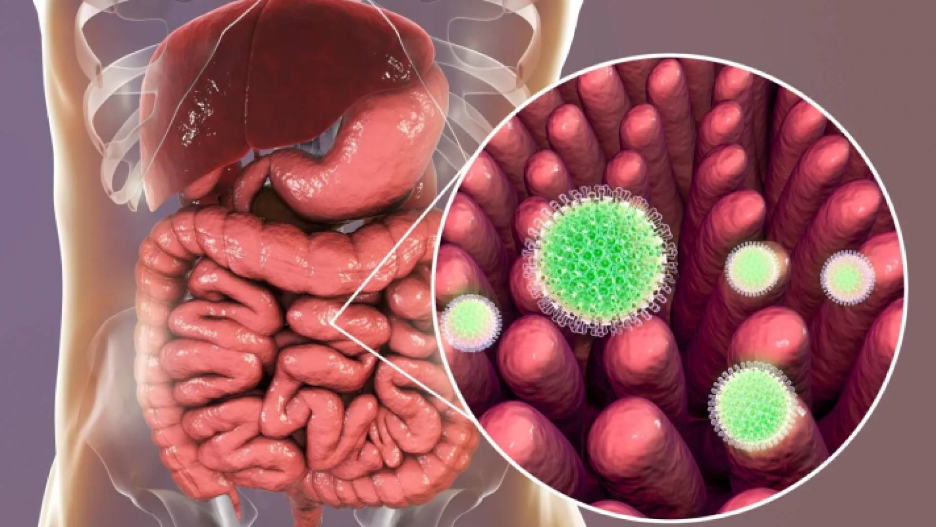 الفيروسة العجلية (فيروس الروتا)