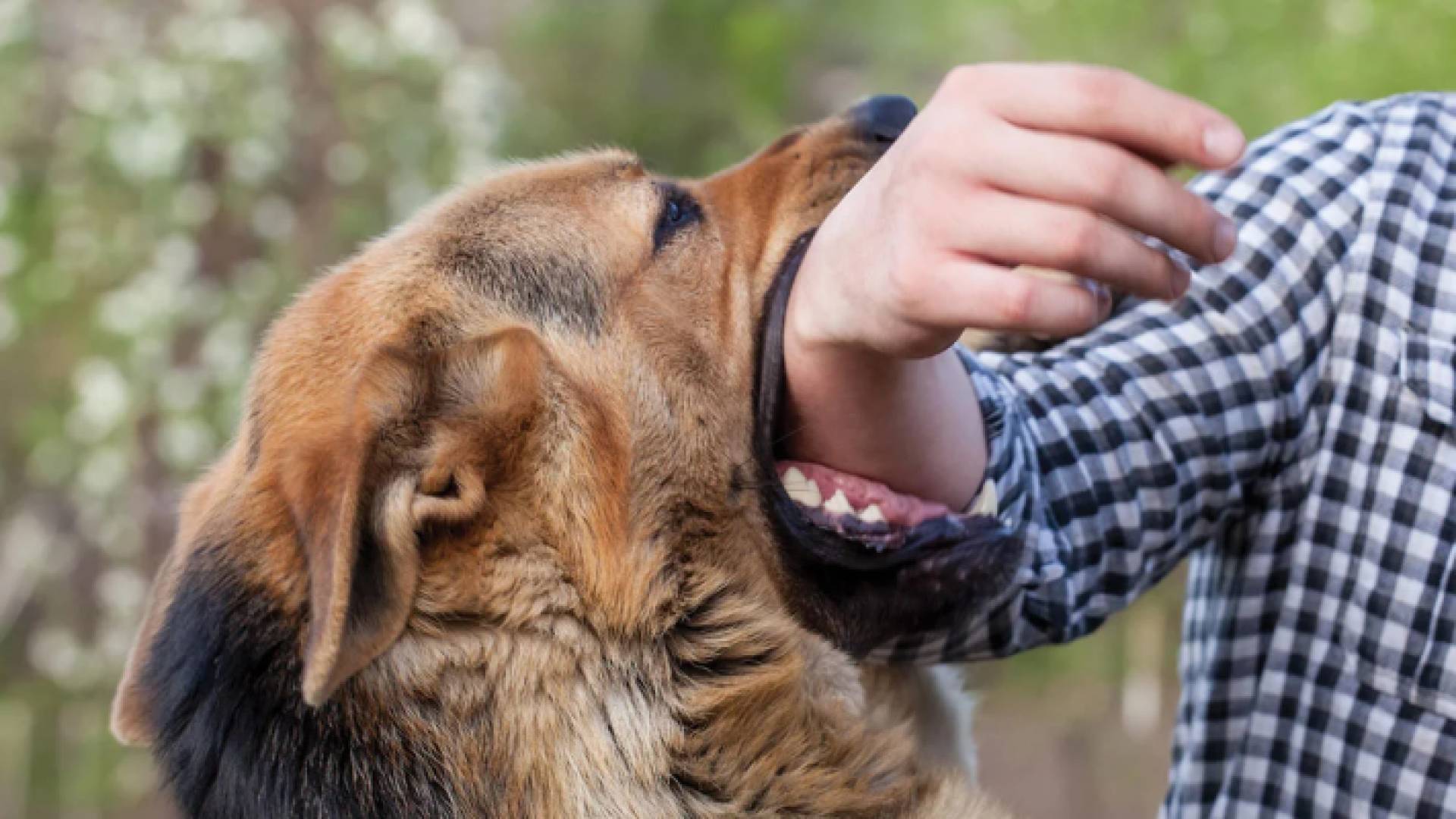 كلب يعقر يد شخص "أرشيفية"