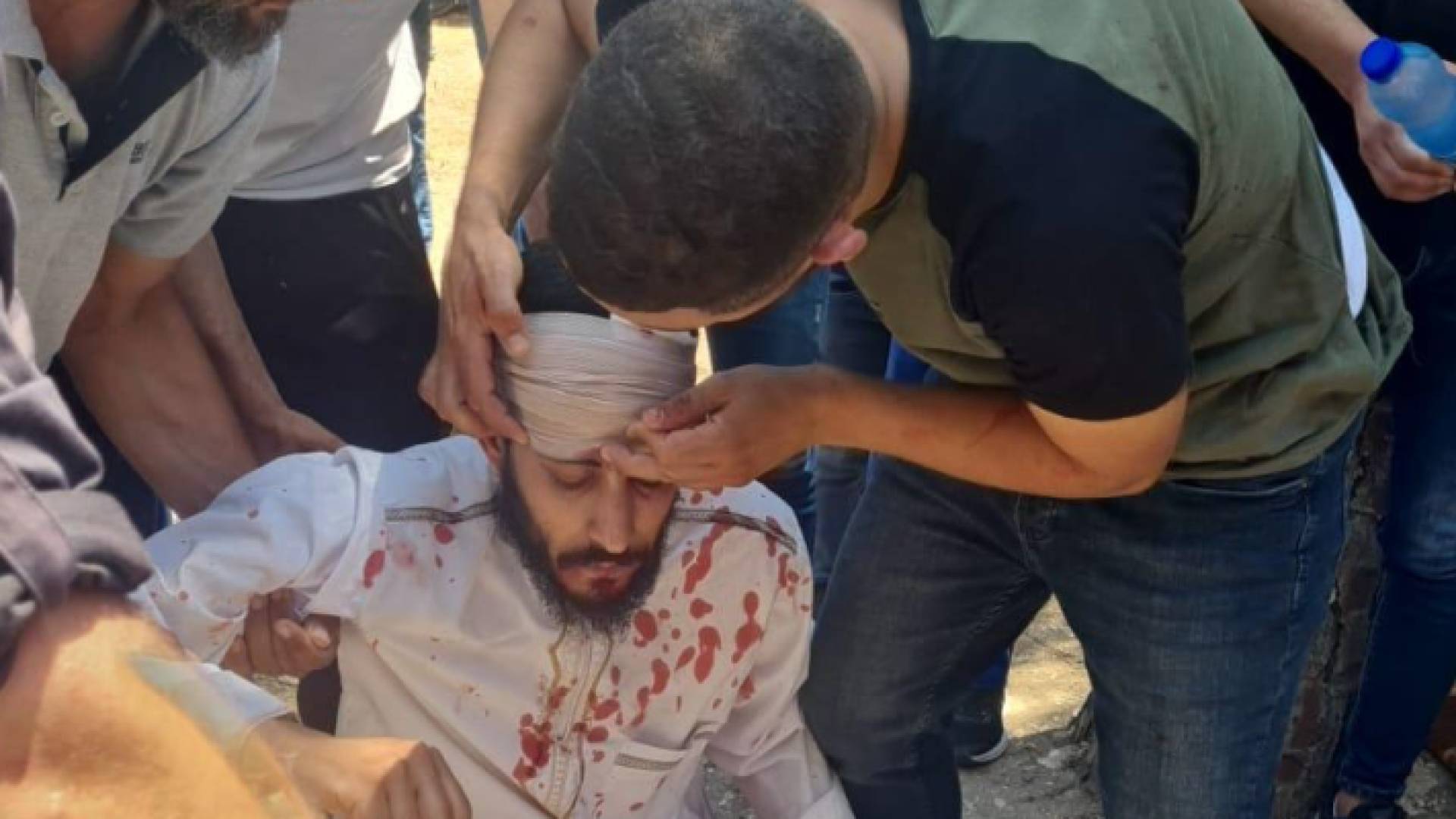 أحد المصلين عقب الاعتداء عليه من قبل شرطة الاحتلال