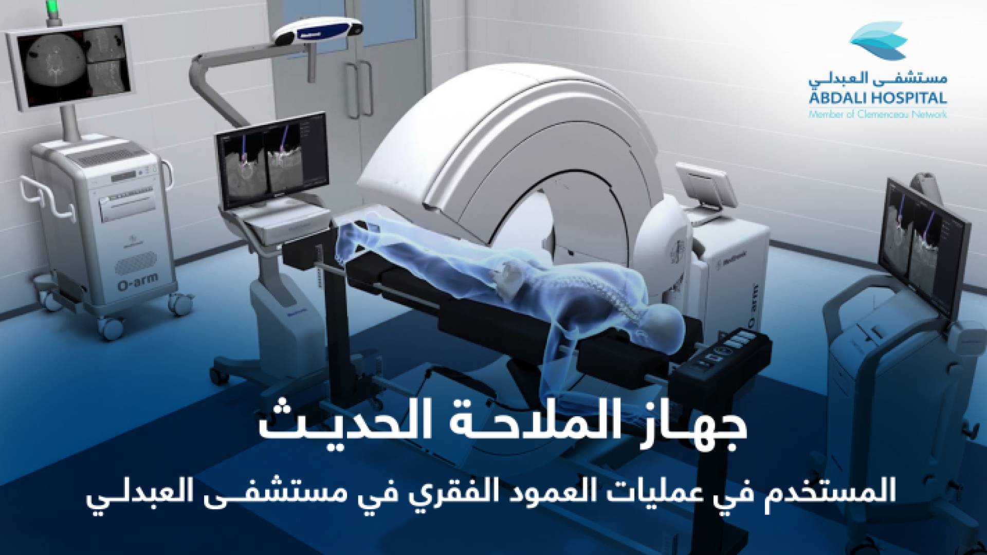 مستشفى العبدلي يبدأ بإجراء عمليات جراحة العمود الفقري باستخدام جهاز الملاحة الحديث
