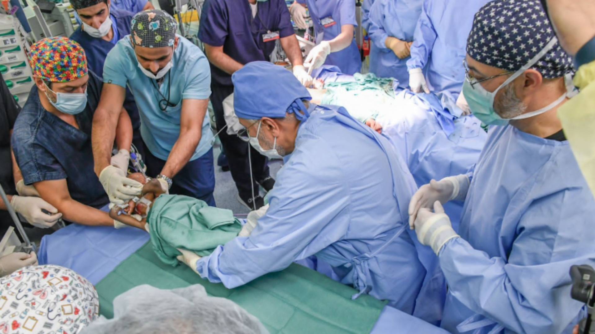 الأطباء أثناء إجراء عملية فصل التوأم التنزاني